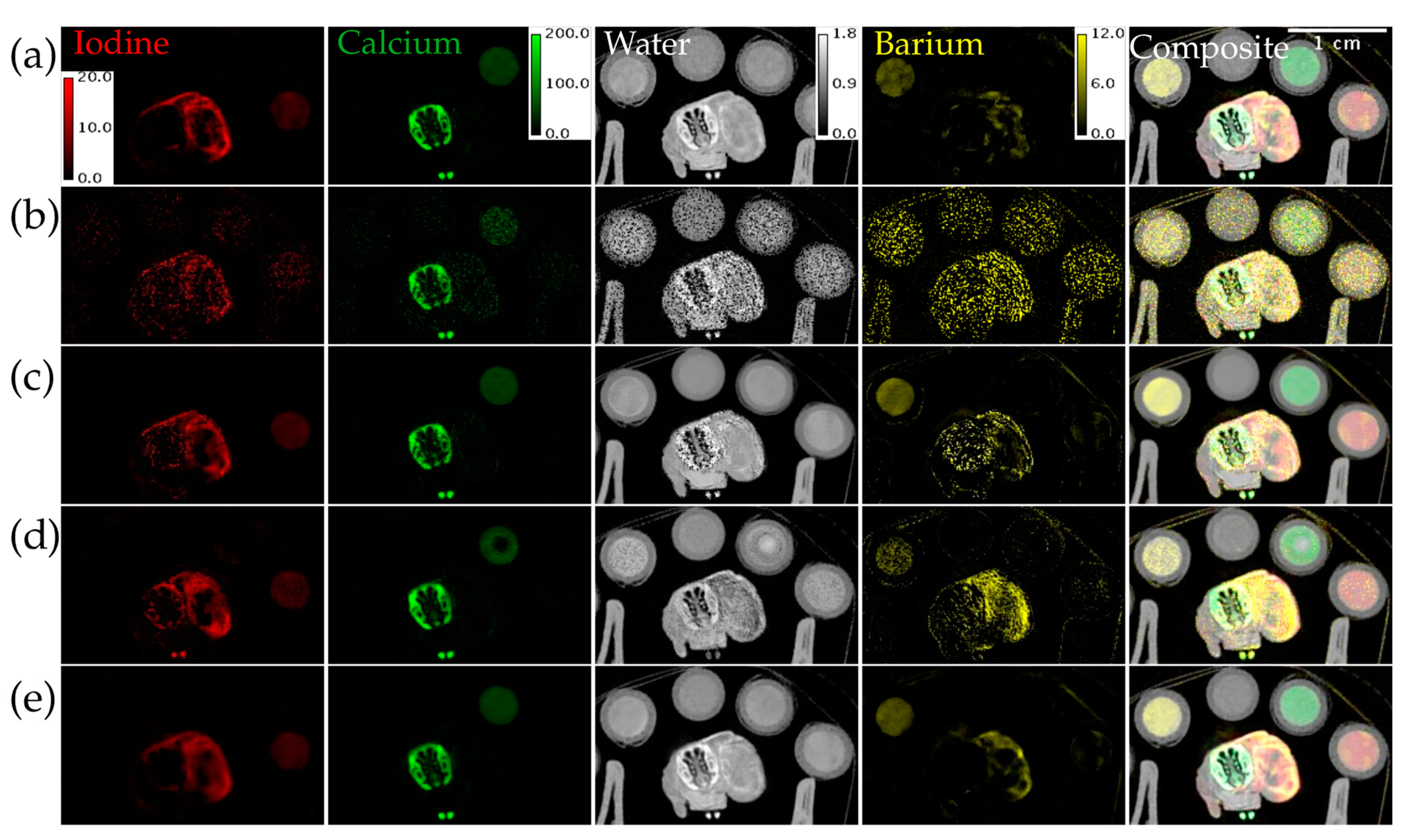 Tomography 09 00102 g008
