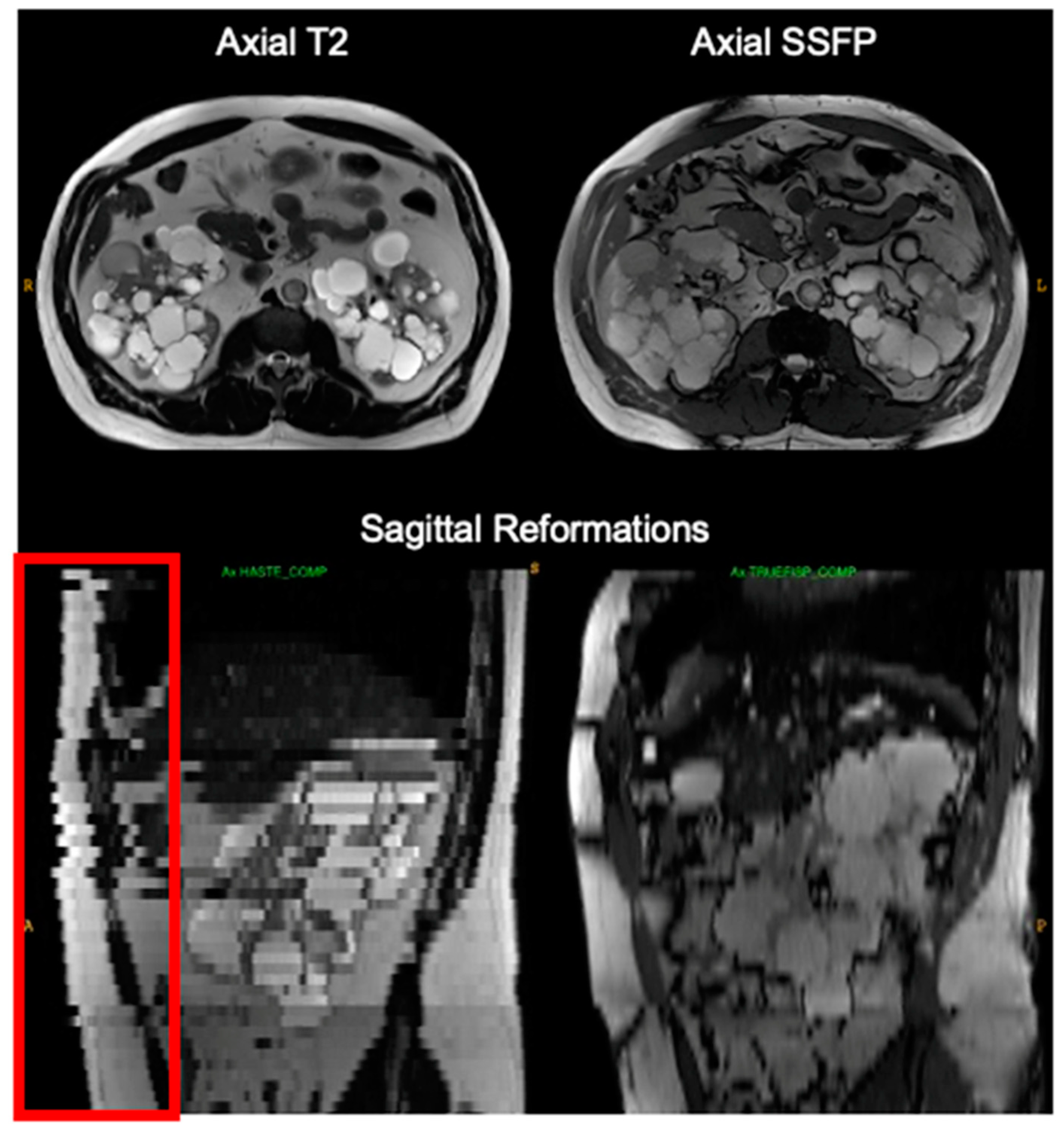 Tomography 09 00107 g003