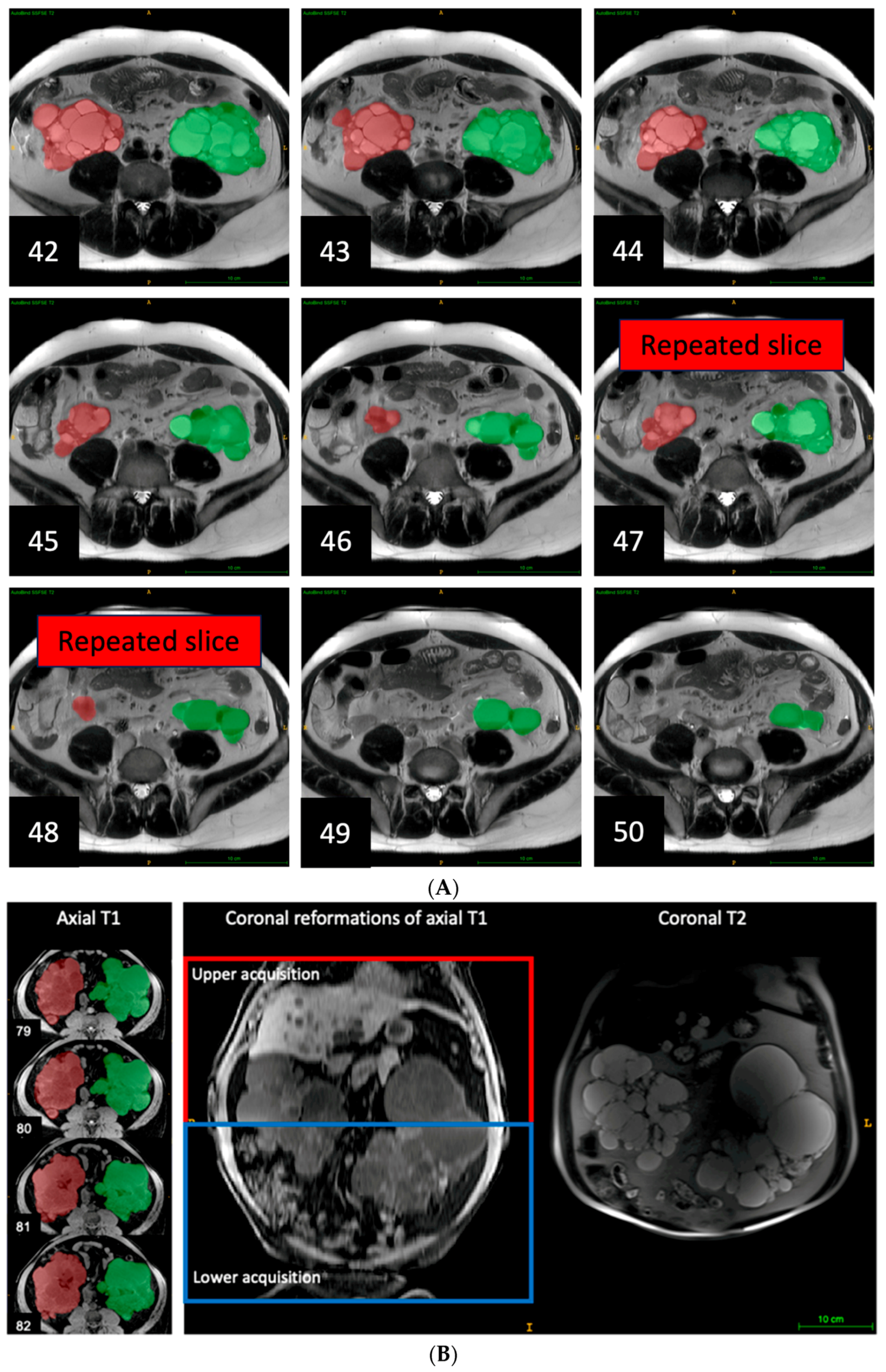 Tomography 09 00107 g004