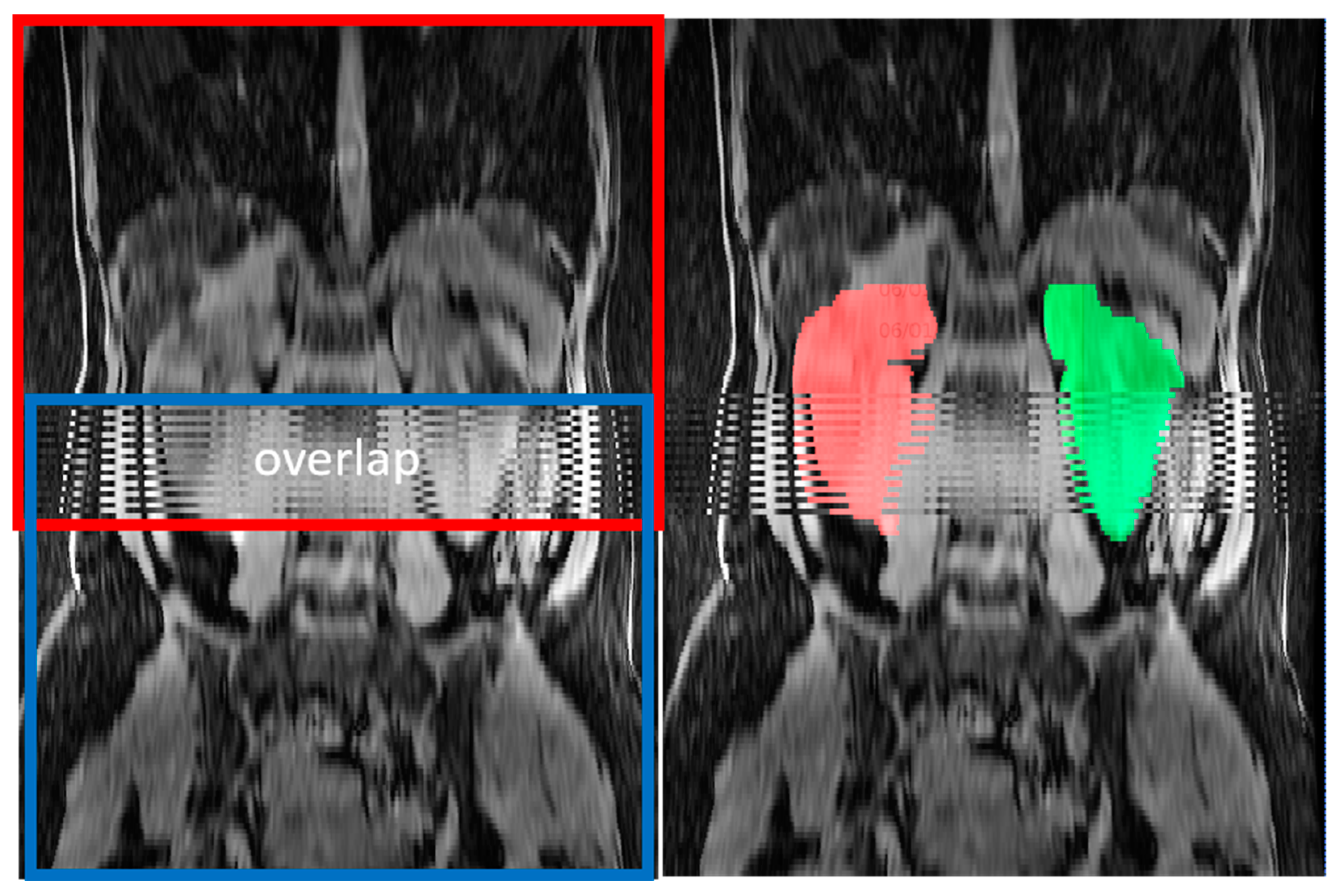 Tomography 09 00107 g005