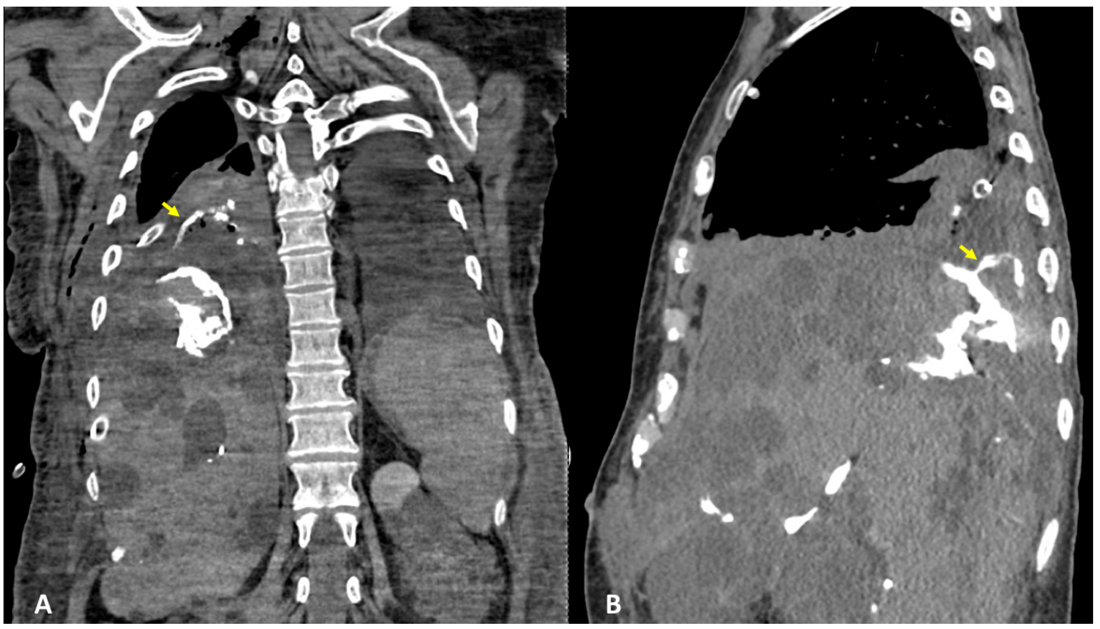 Tomography 09 00108 g003