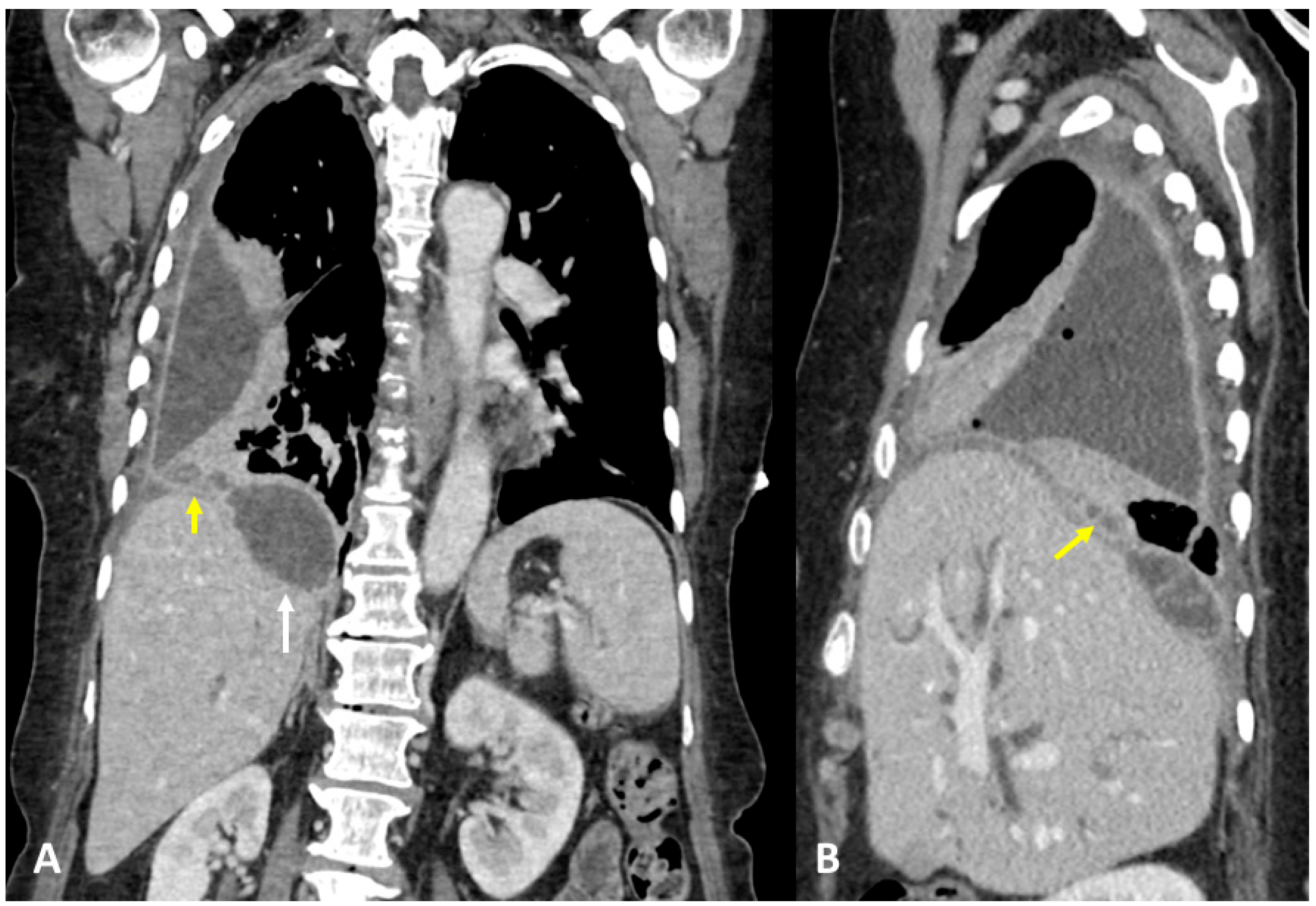Tomography 09 00108 g005