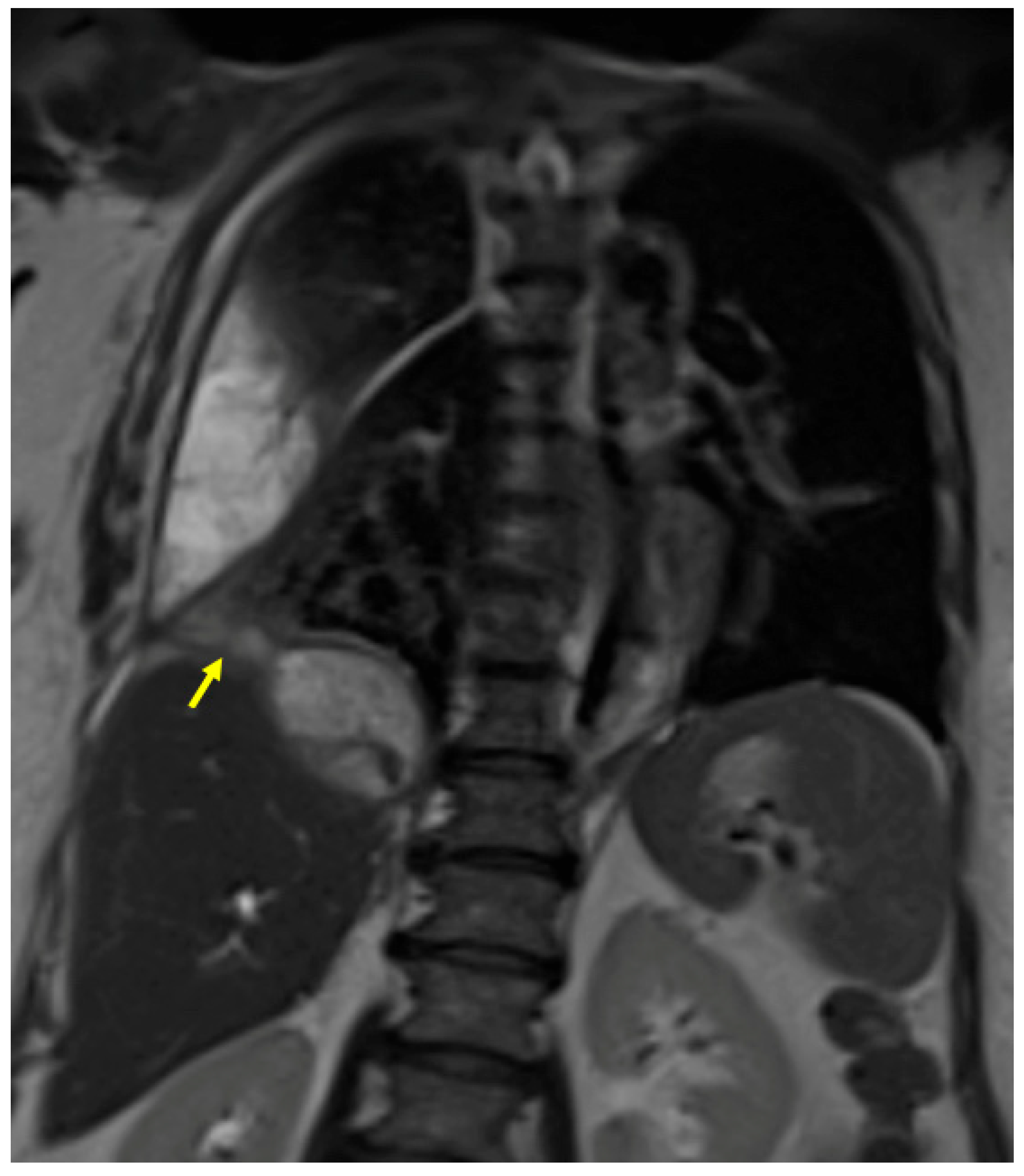 Tomography 09 00108 g006