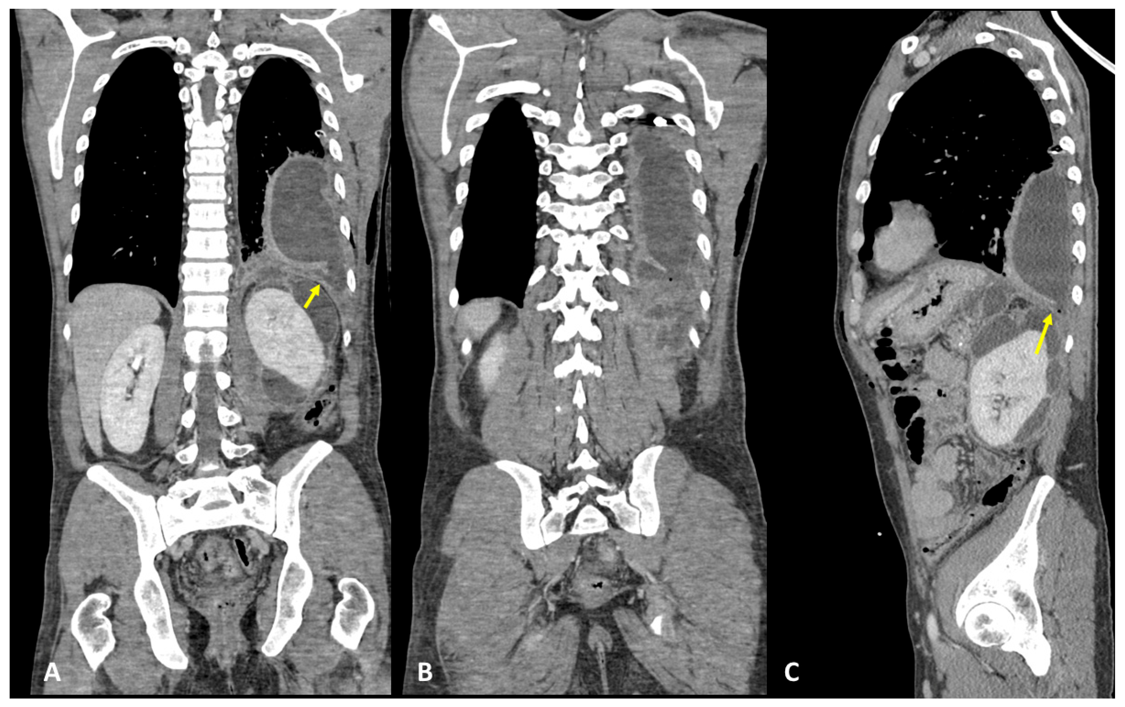 Tomography 09 00108 g007