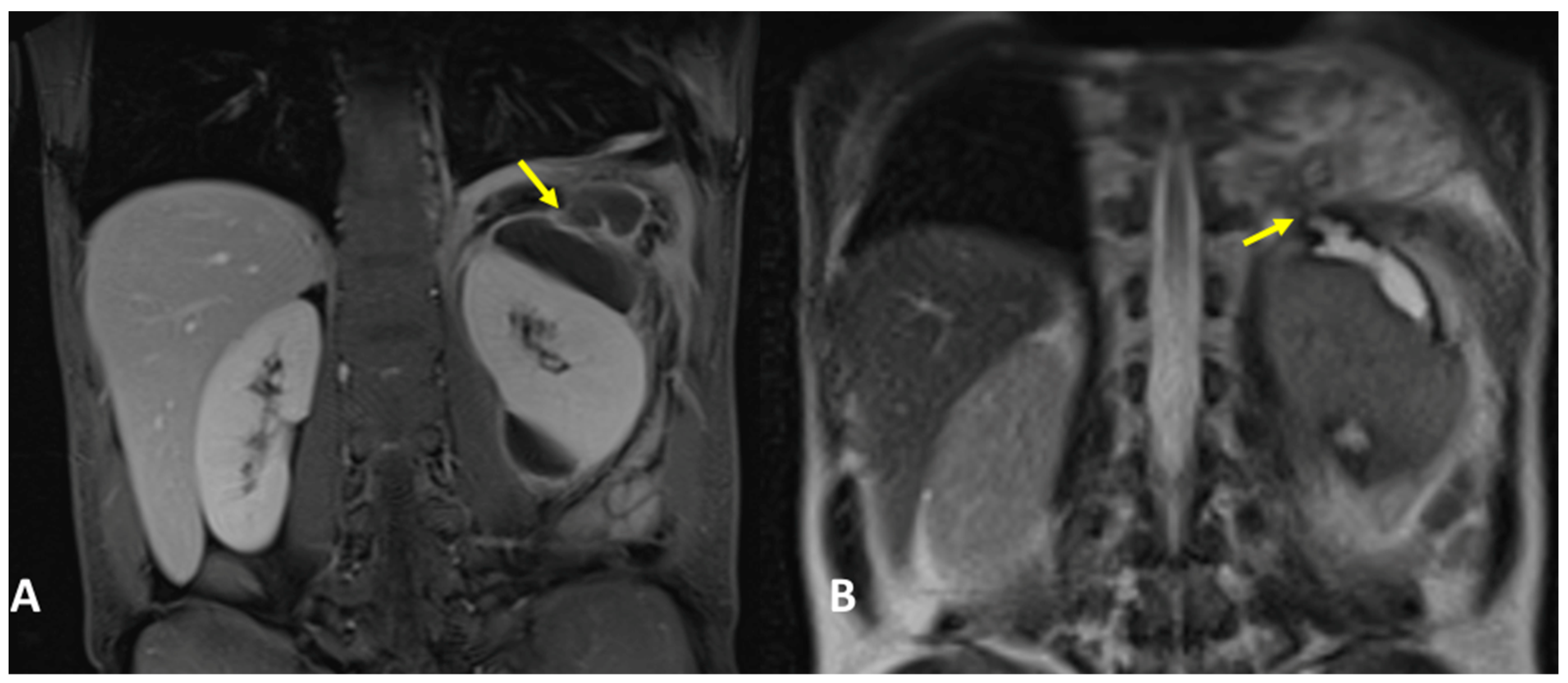 Tomography 09 00108 g008