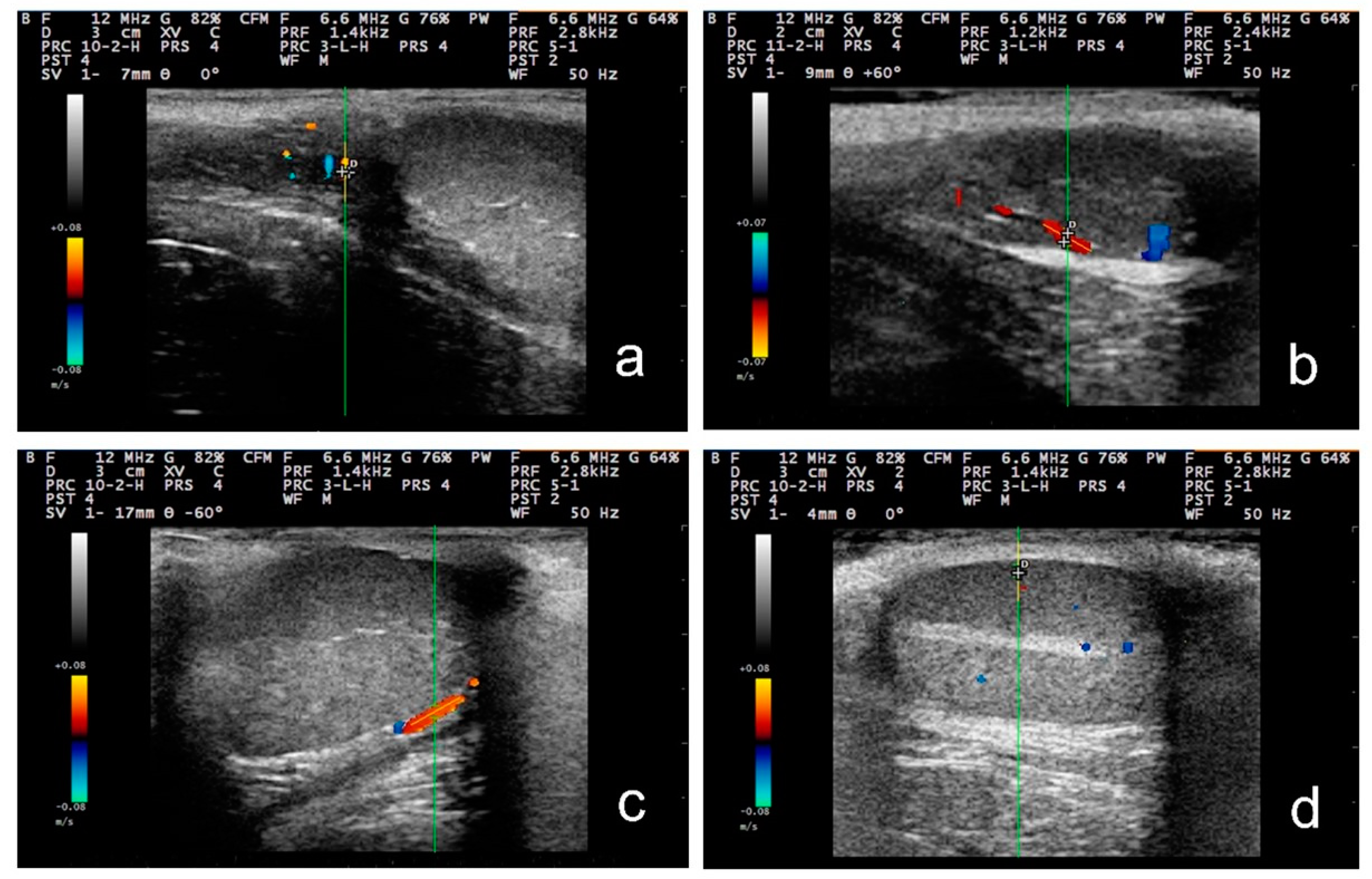 Tomography 09 00112 g002 Tomography 09 00112 g002