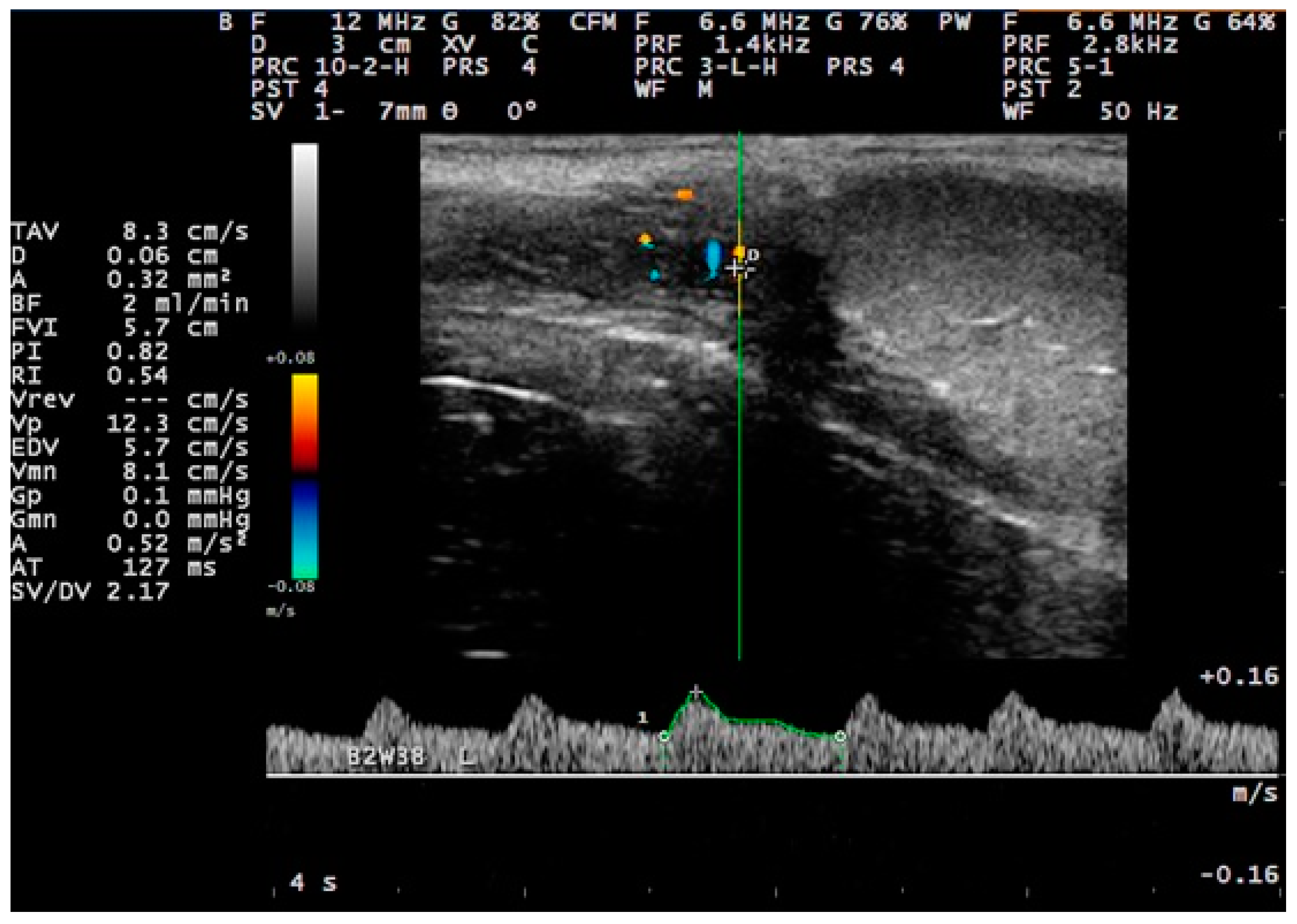 Tomography 09 00112 g003 Tomography 09 00112 g003