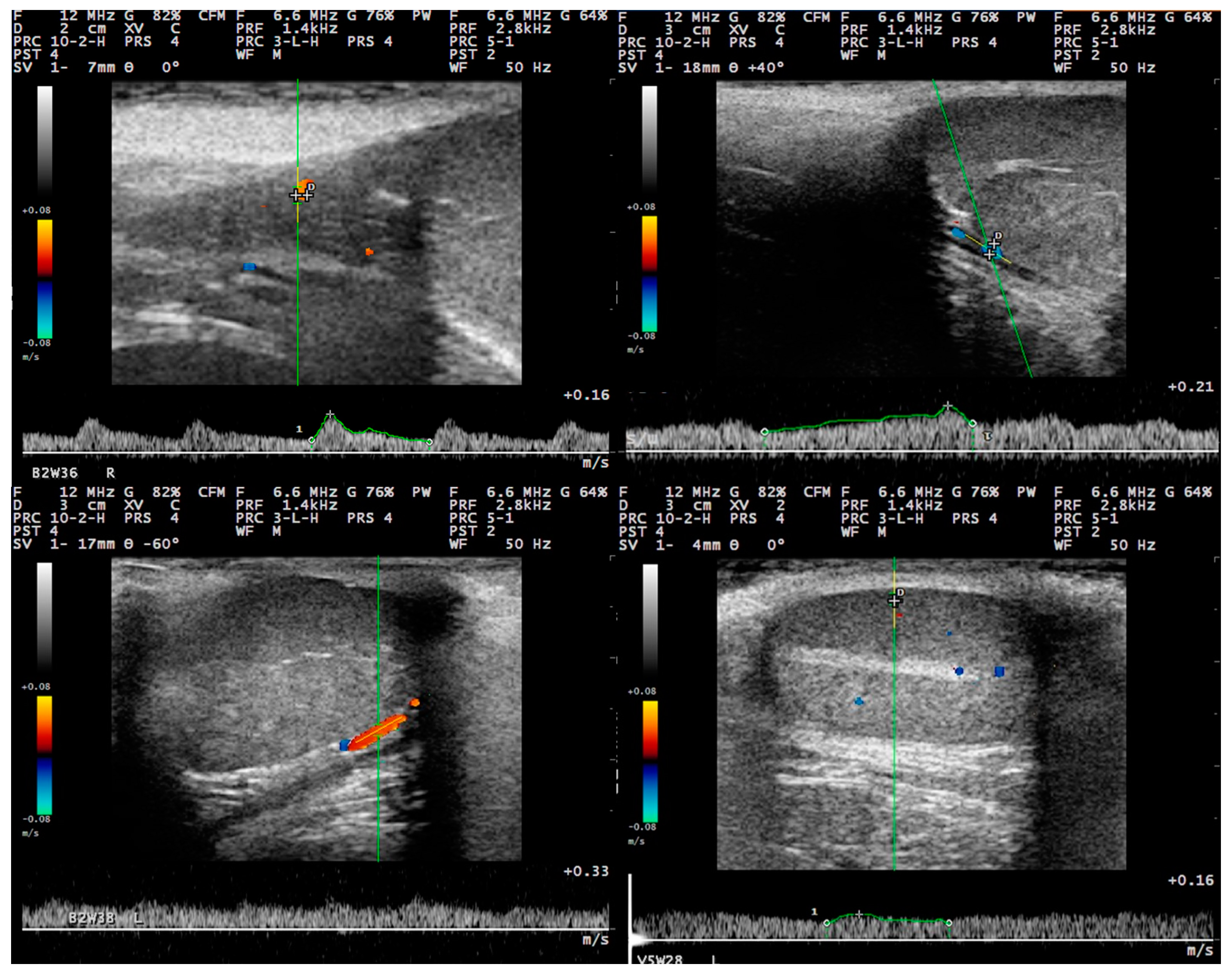 Tomography 09 00112 g006 Tomography 09 00112 g006