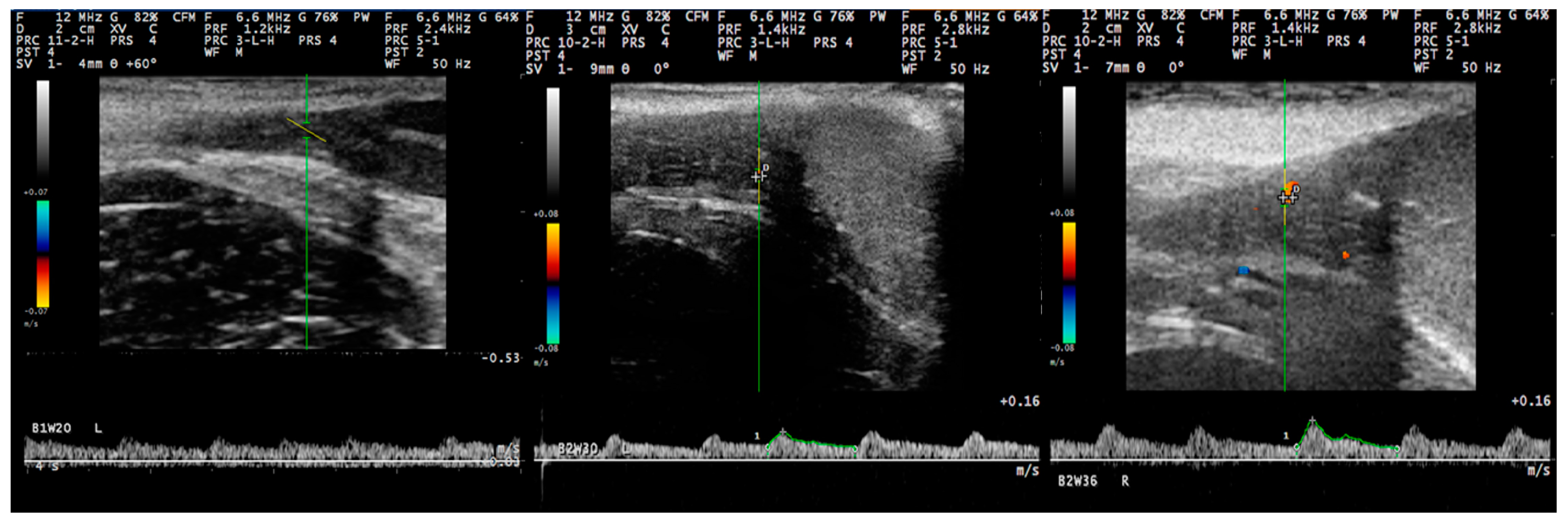 Tomography 09 00112 g007 Tomography 09 00112 g007