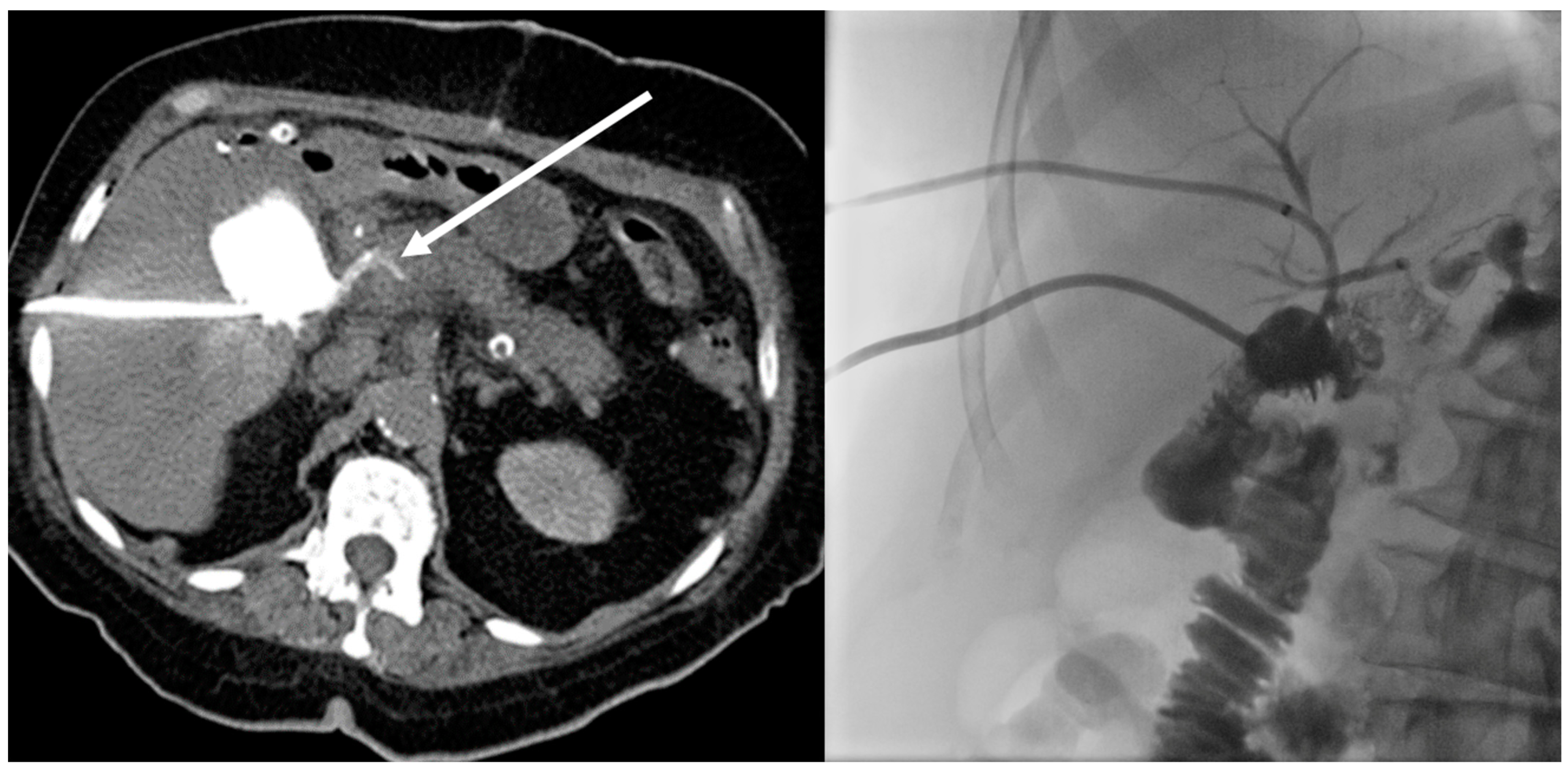 Tomography 09 00114 g003