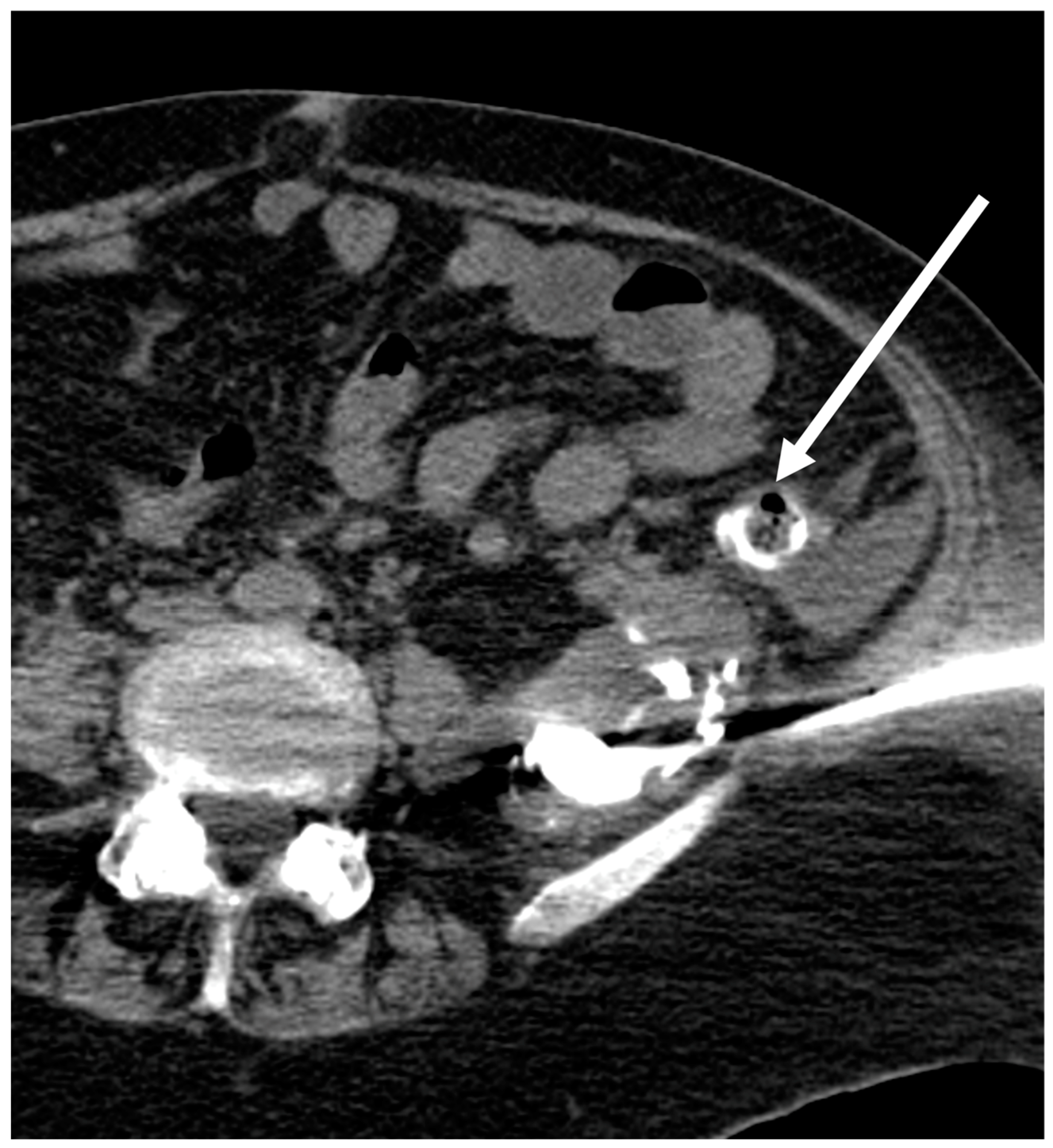 Tomography 09 00114 g004