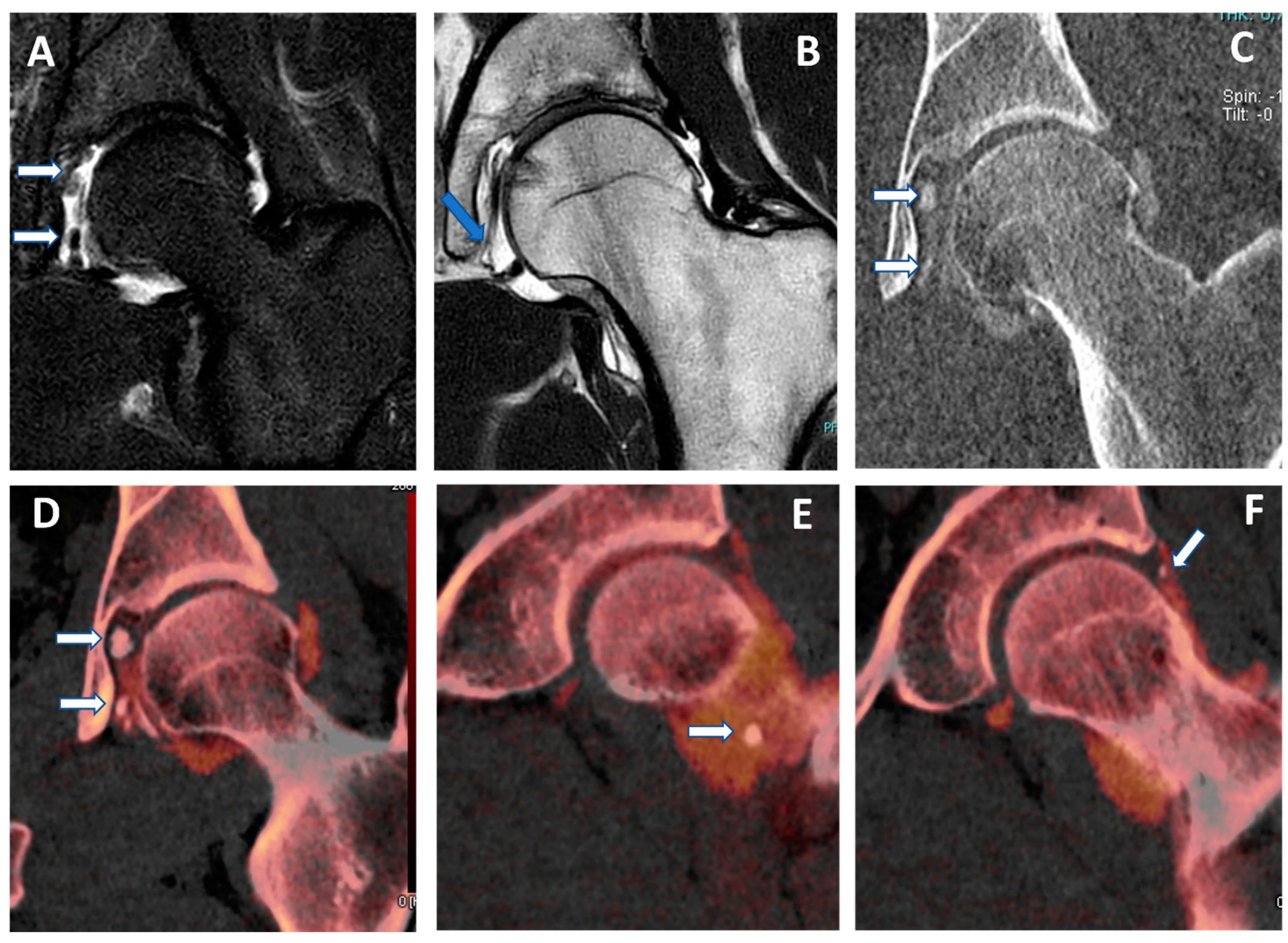 Tomography 09 00117 g005