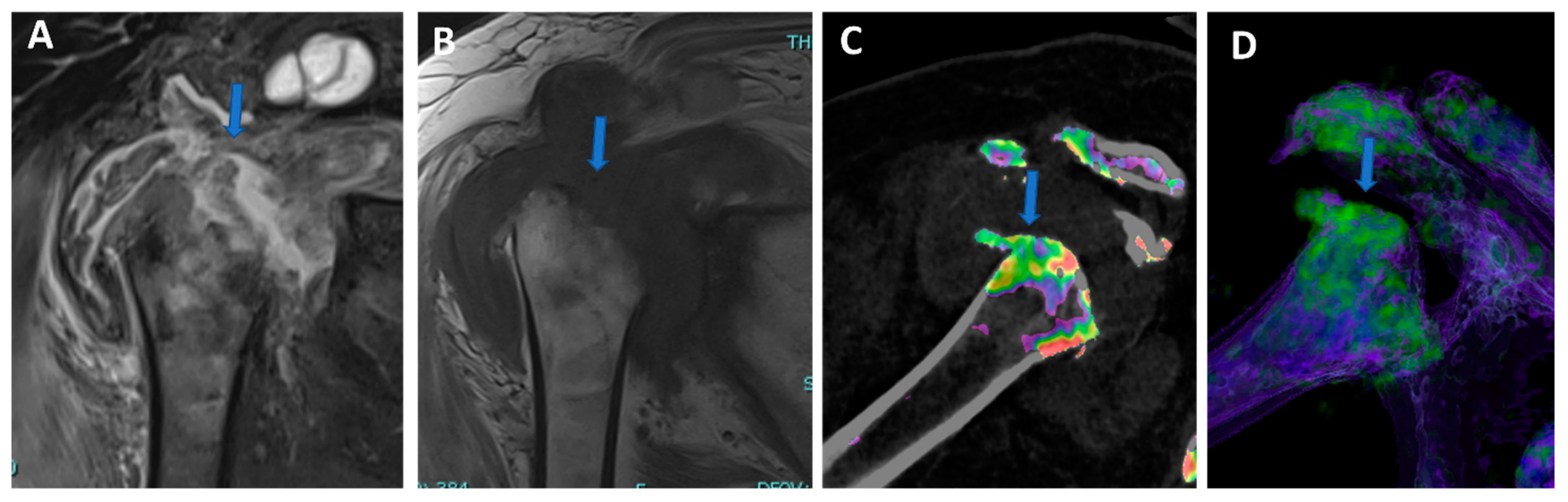 Tomography 09 00117 g007