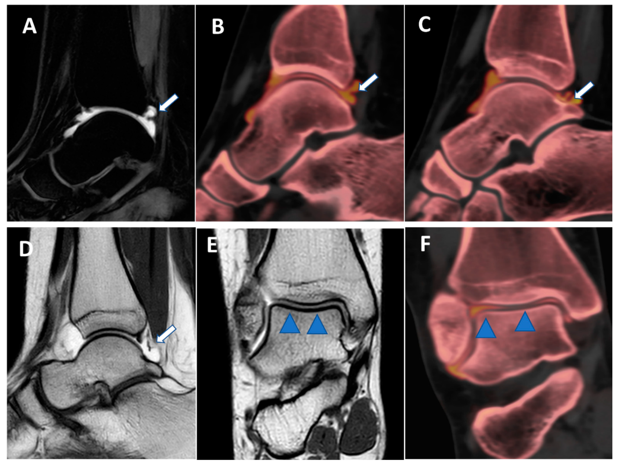 Tomography 09 00117 g008
