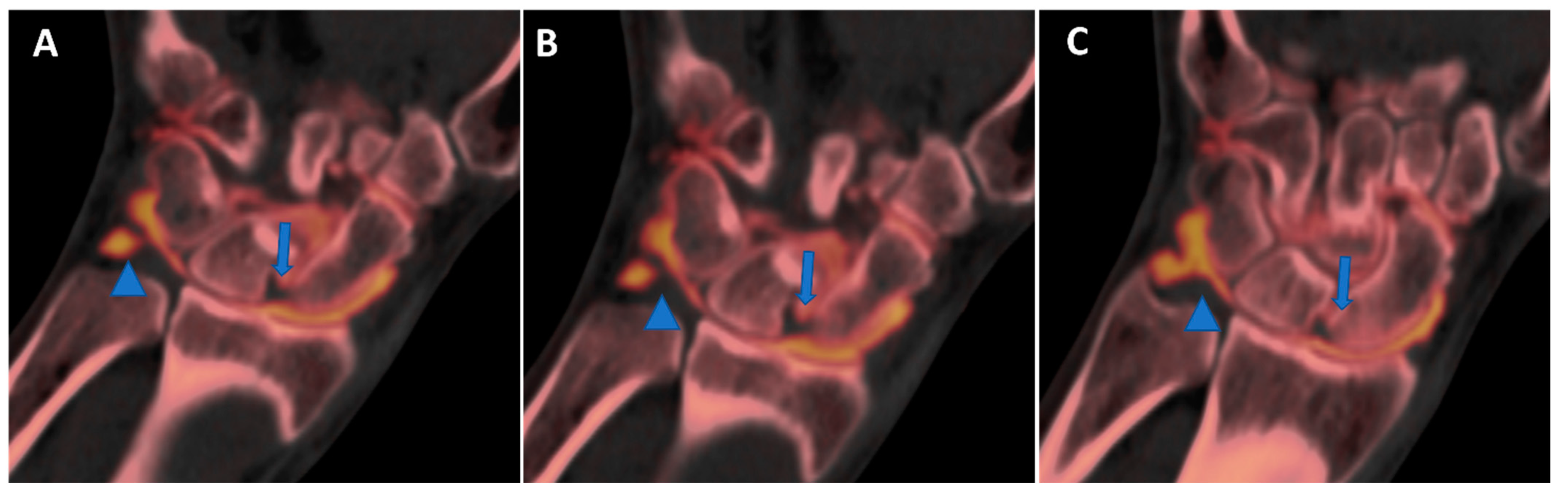 Tomography 09 00117 g010