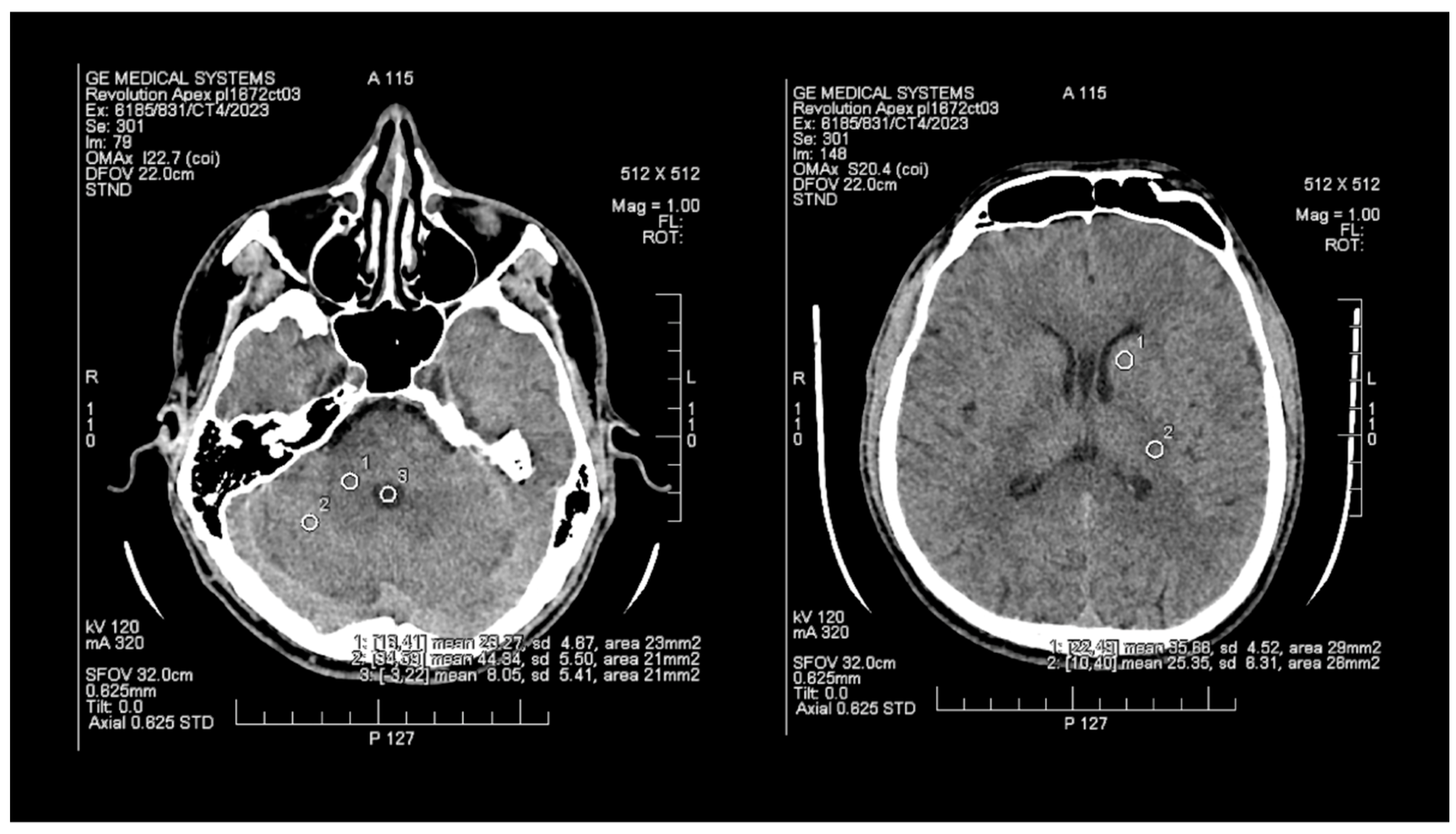 Tomography 09 00118 g001