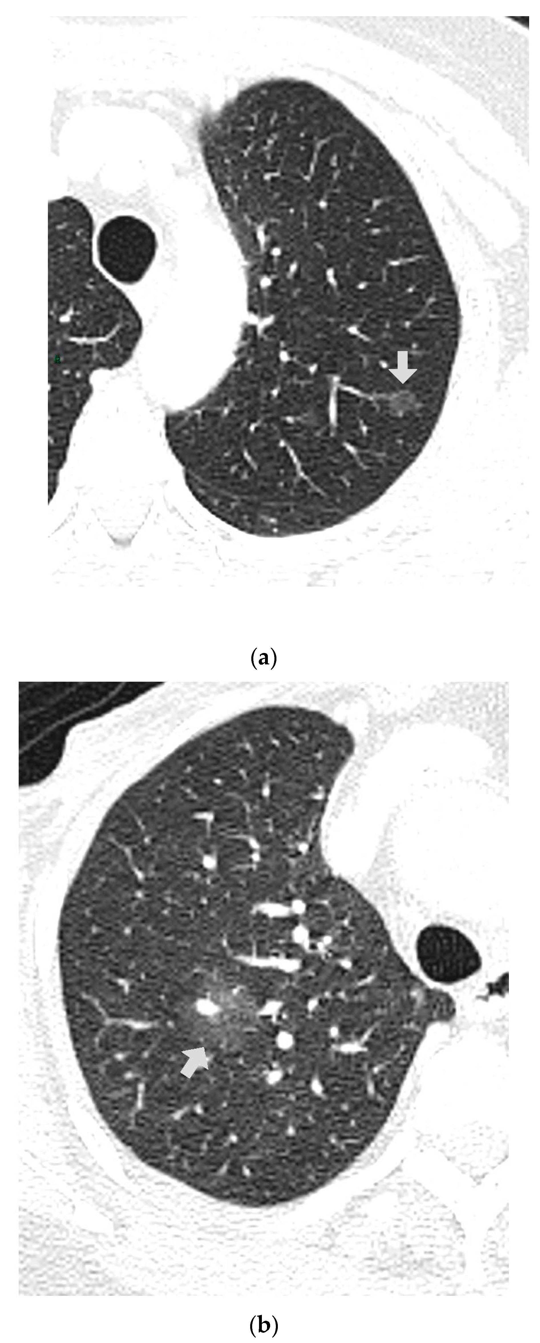 Tomography 09 00119 g001