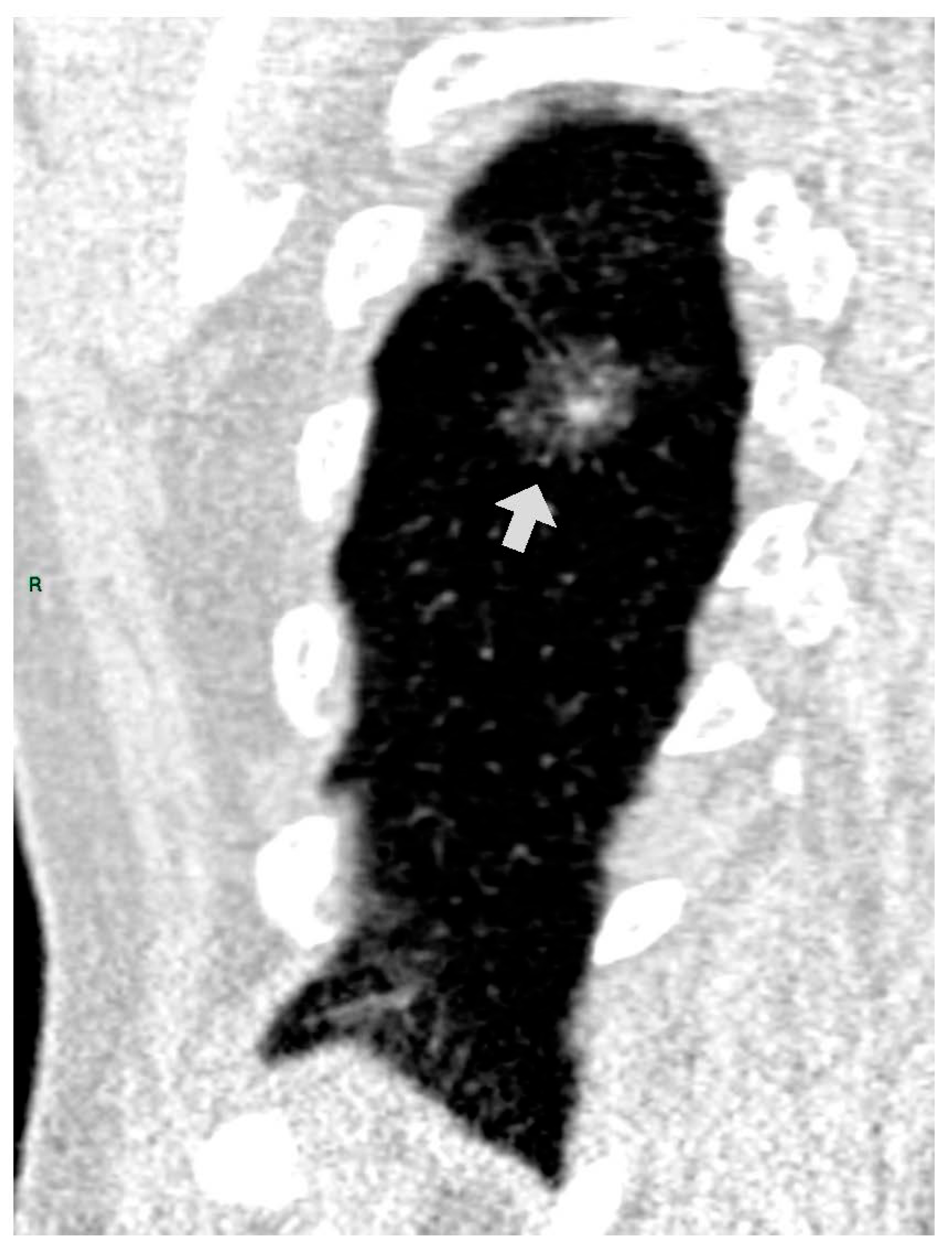 Tomography 09 00119 g003