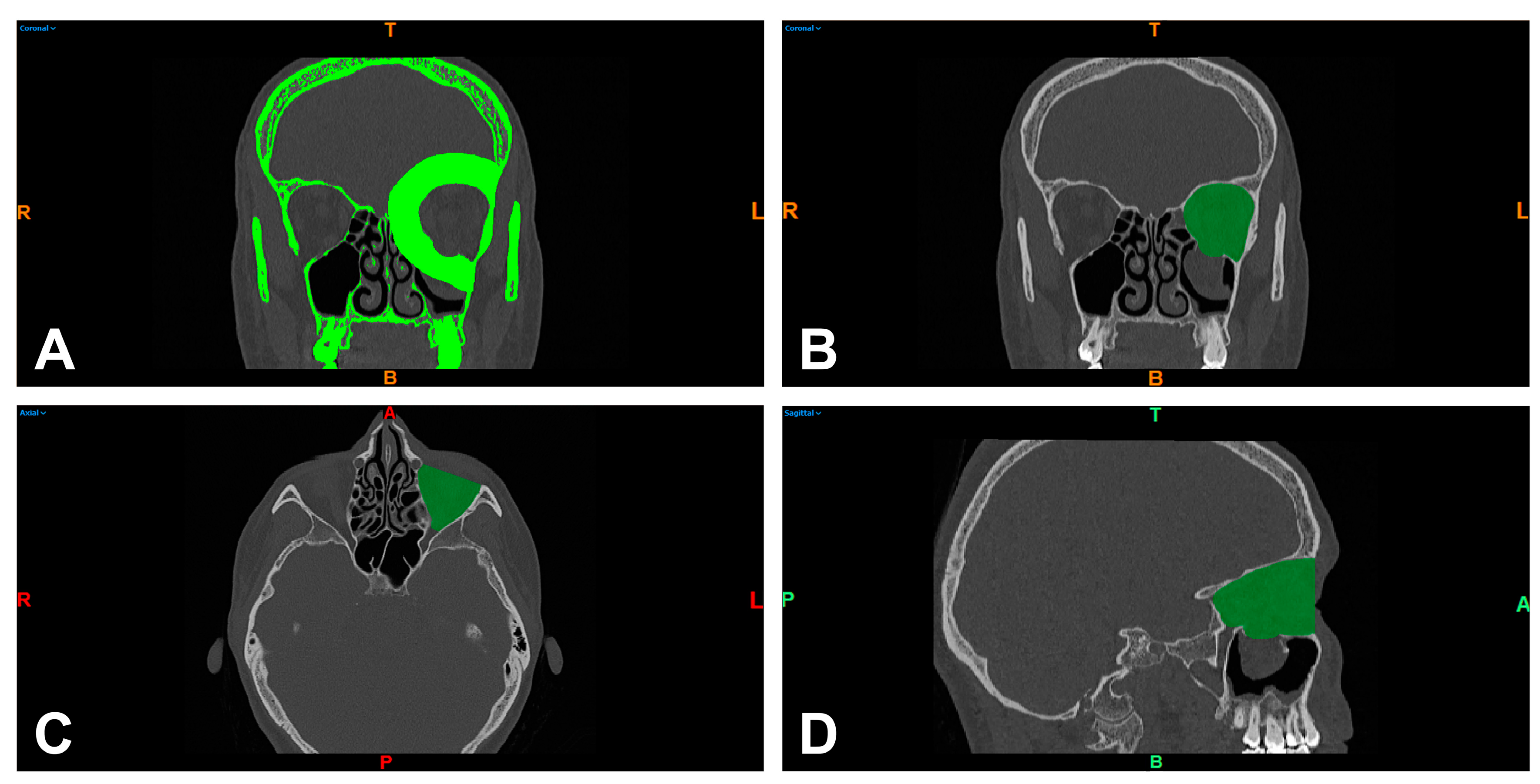 Tomography 09 00121 g002