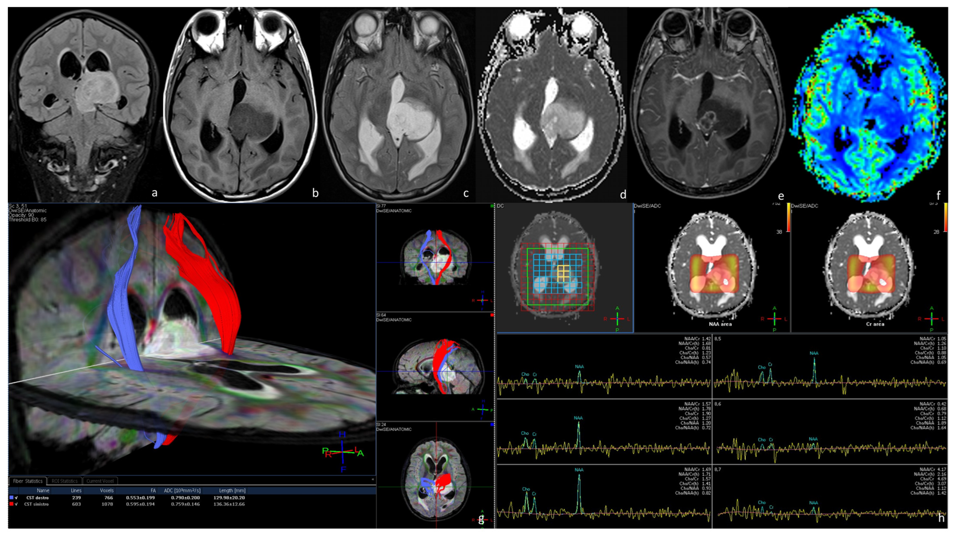 Tomography 09 00122 g002