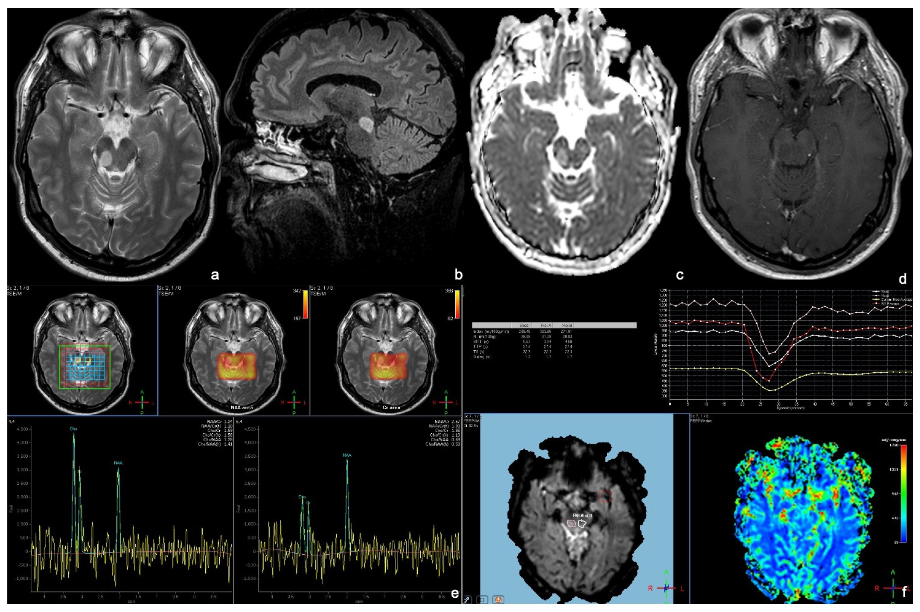 Tomography 09 00122 g003