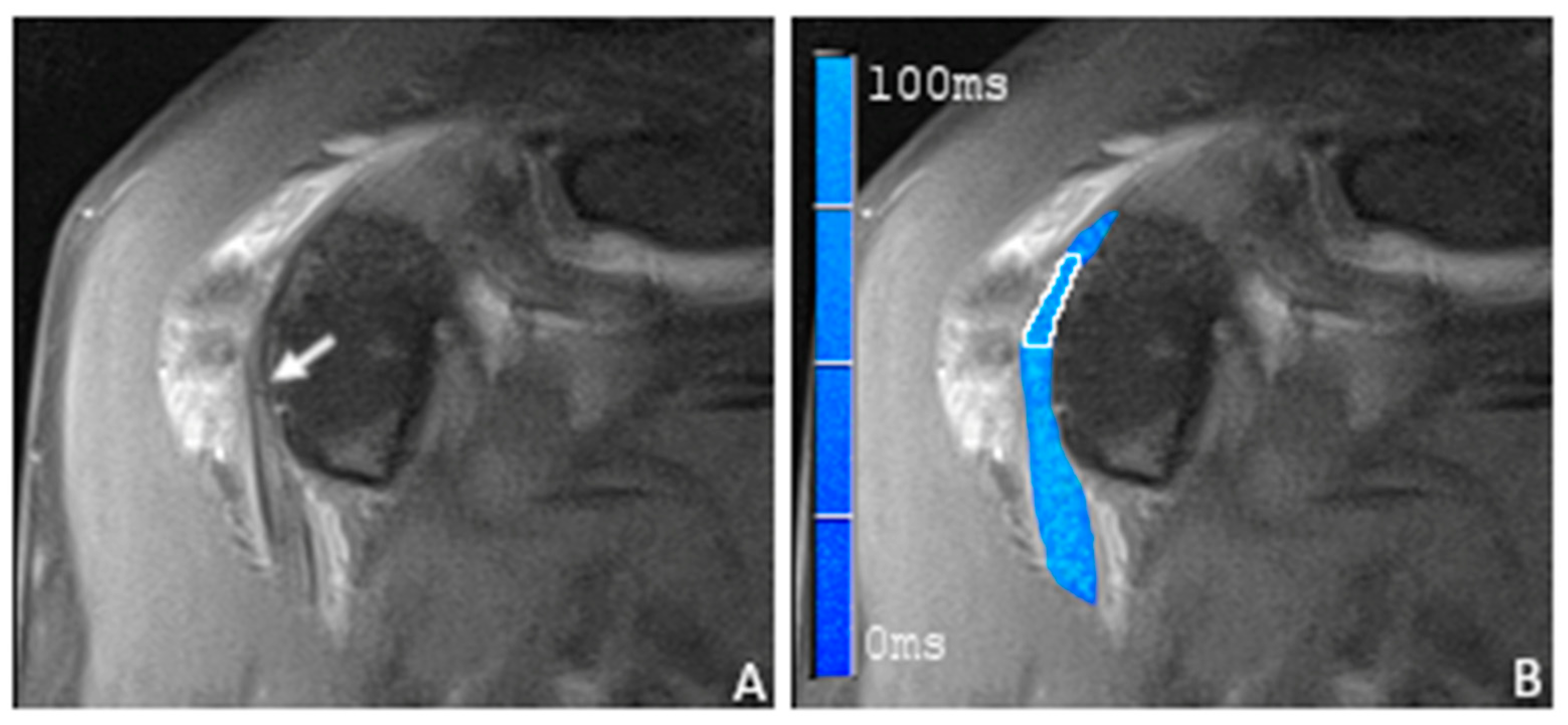 Tomography 09 00126 g005 Tomography 09 00126 g005