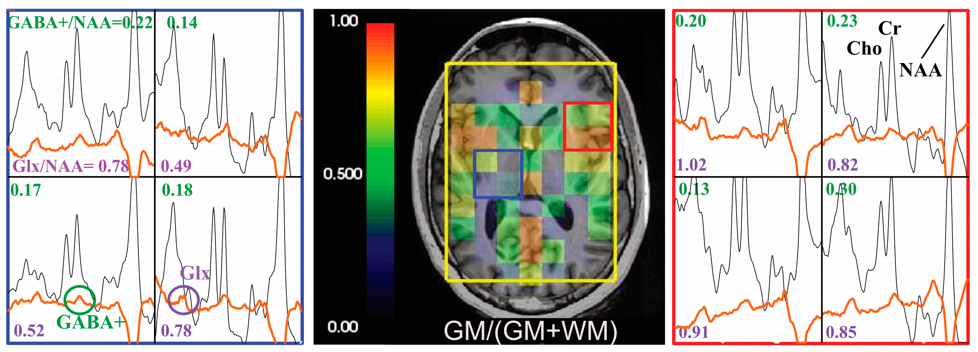 Tomography 09 00127 g004 Tomography 09 00127 g004