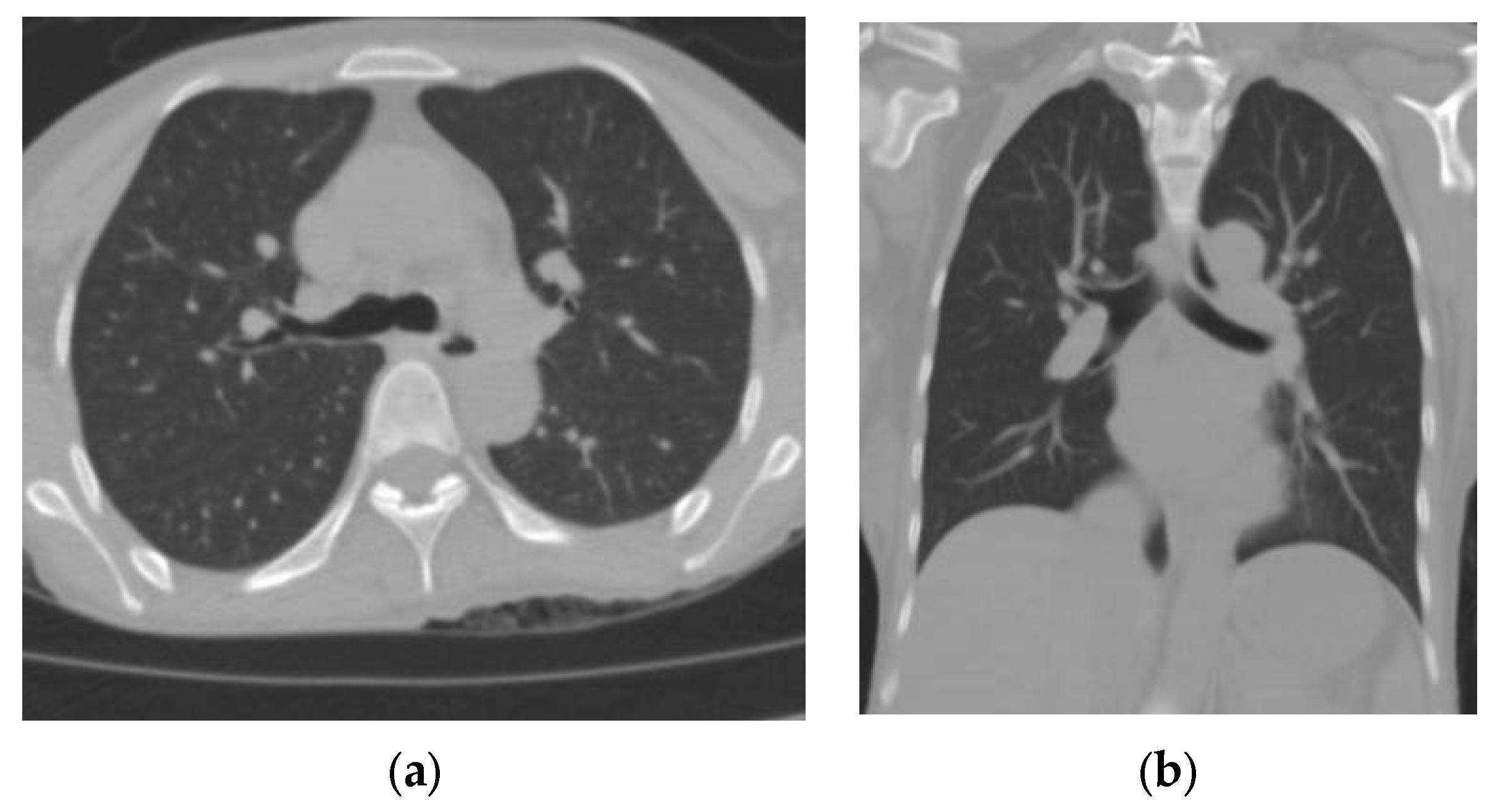 Tomography 09 00129 g001