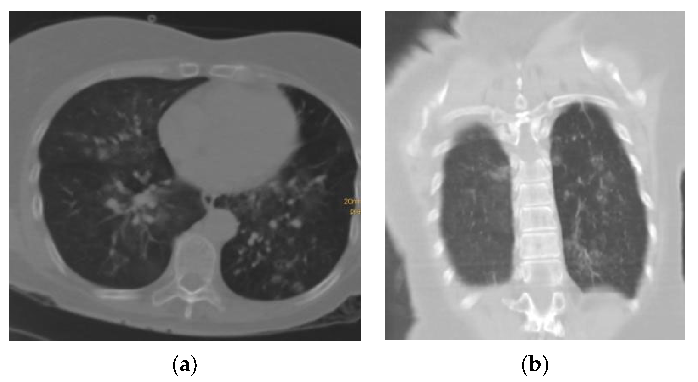 Tomography 09 00129 g004