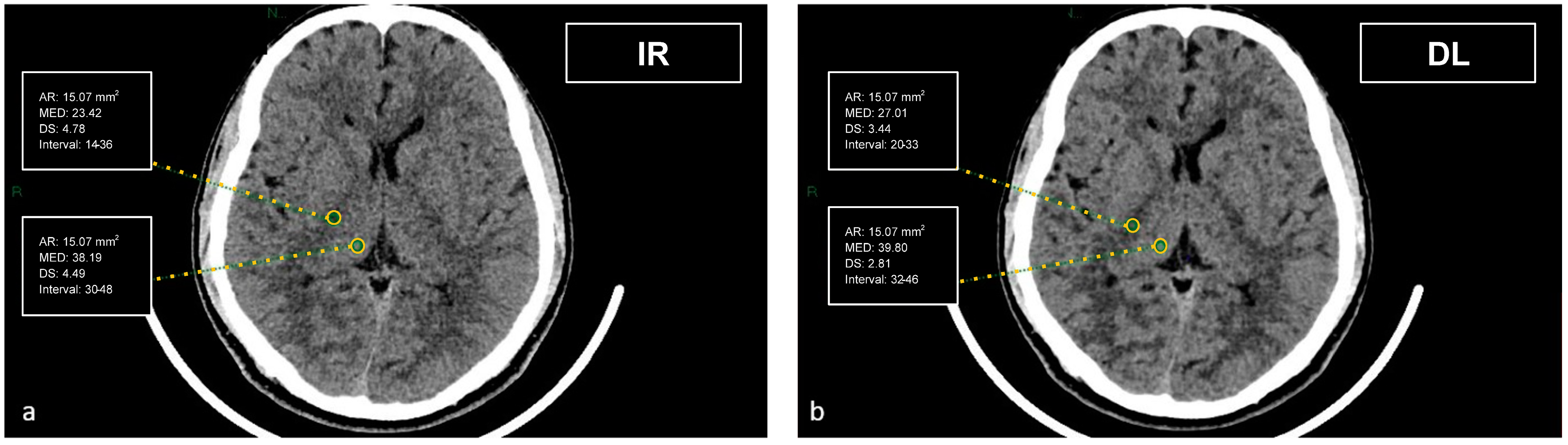 Tomography 09 00130 g002