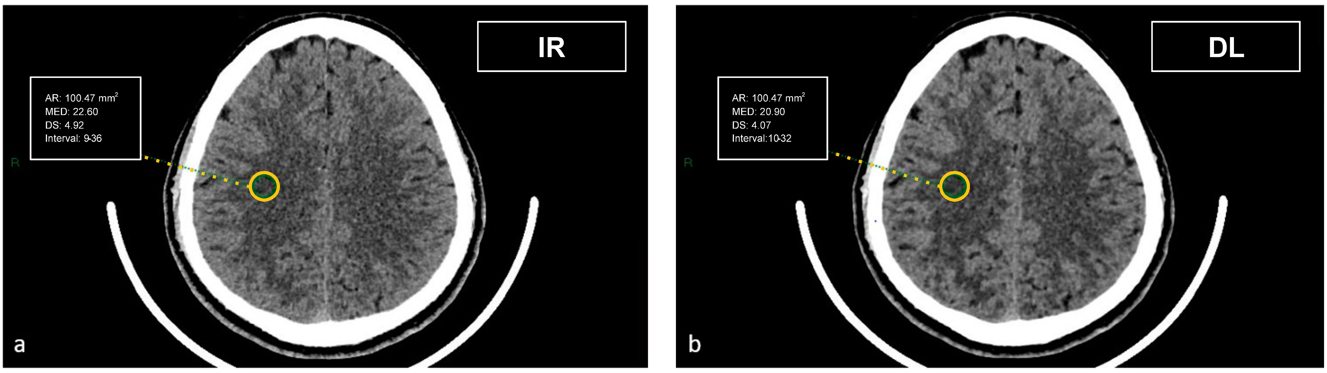 Tomography 09 00130 g004