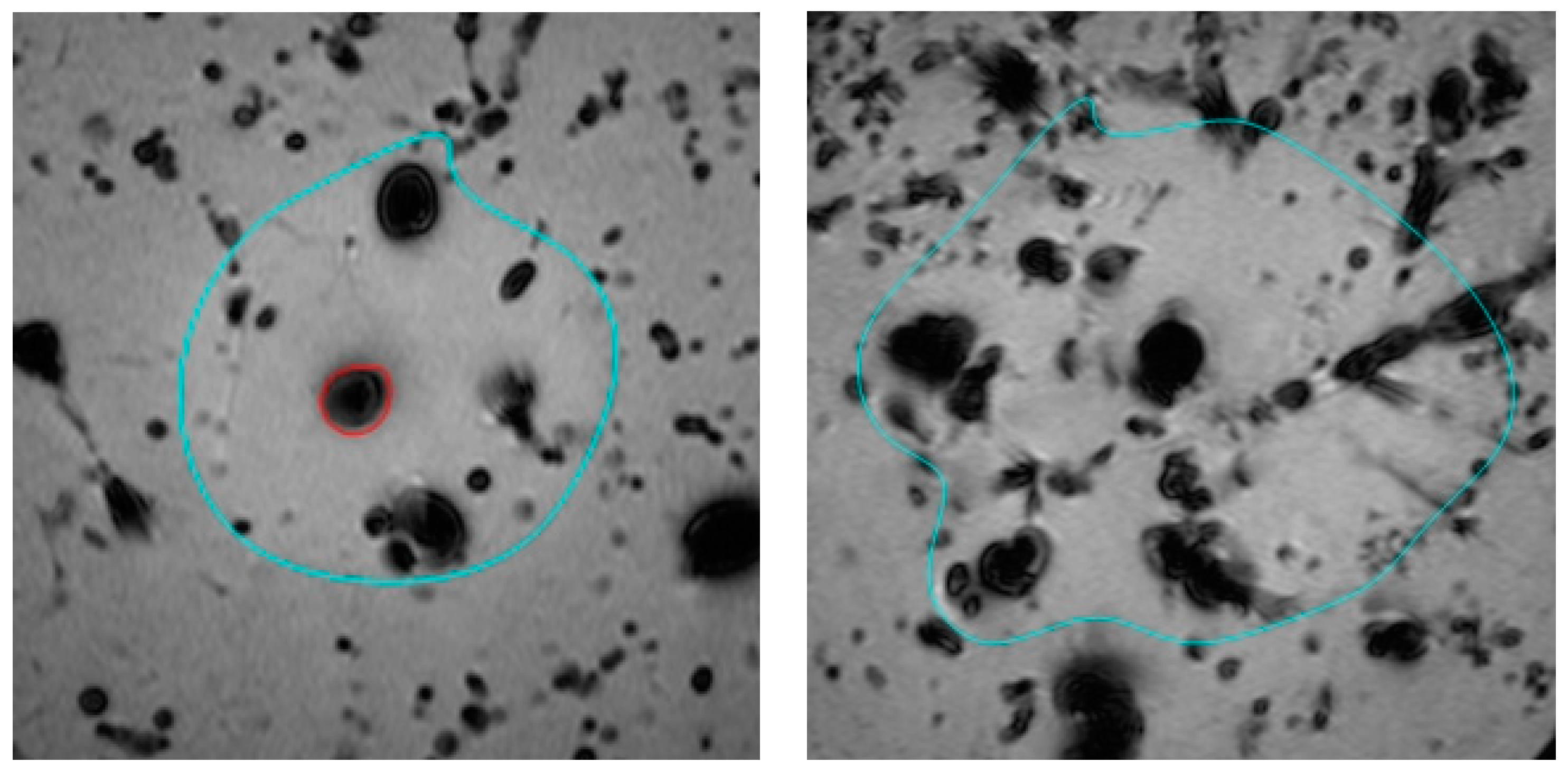 Tomography 09 00131 g002 Tomography 09 00131 g002