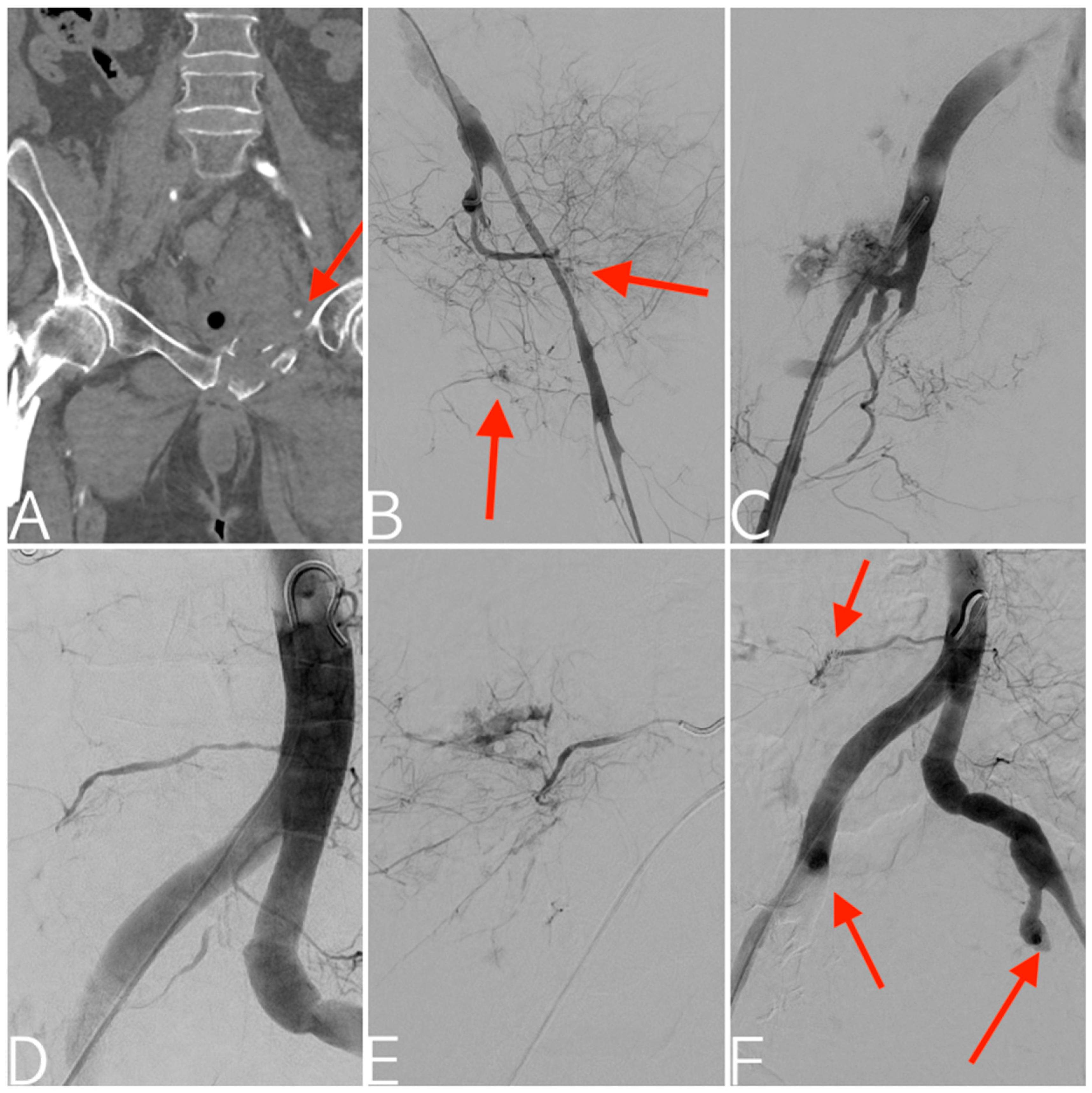 Tomography 09 00133 g003 Tomography 09 00133 g003
