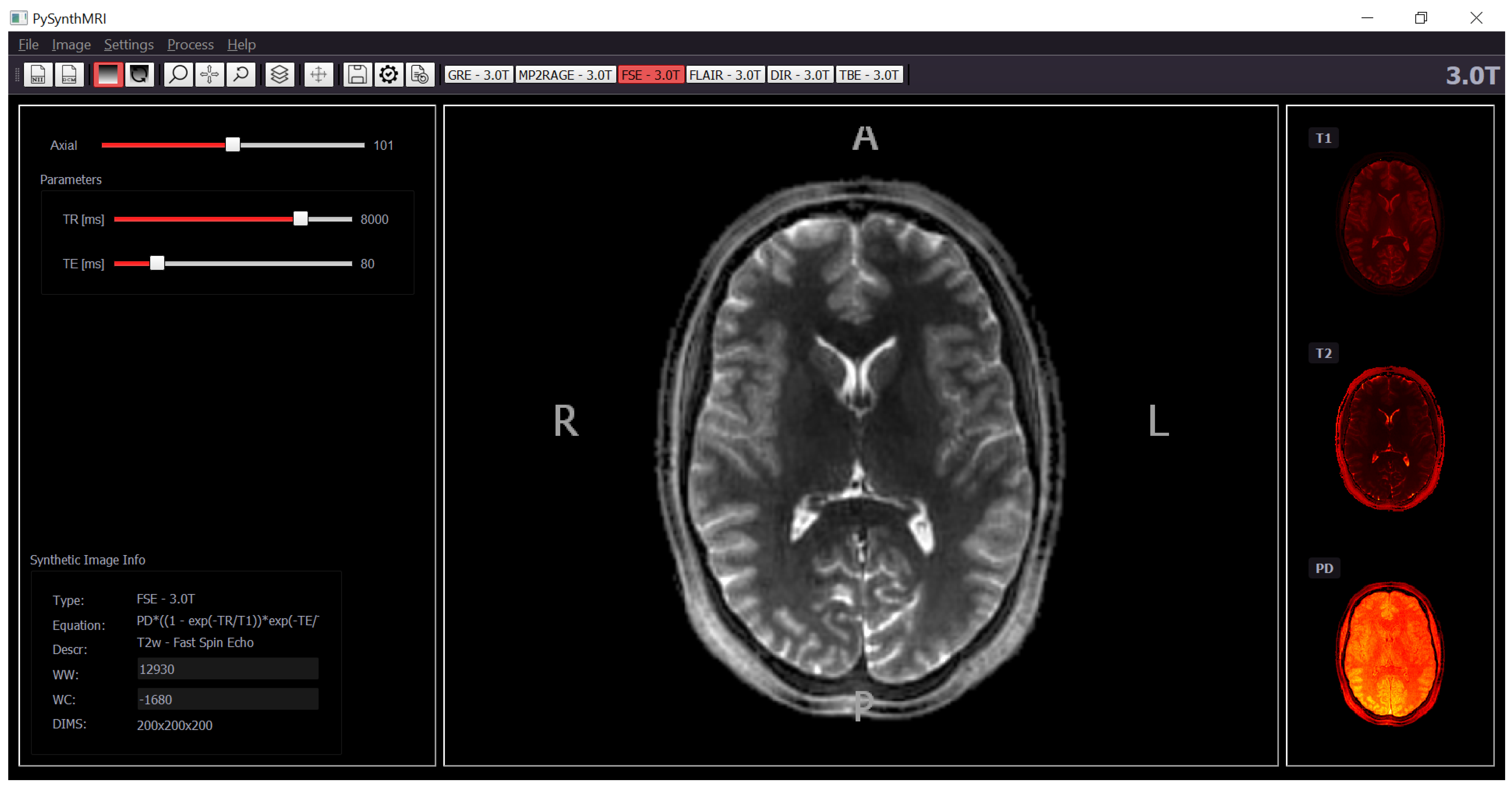 Tomography 09 00137 g001