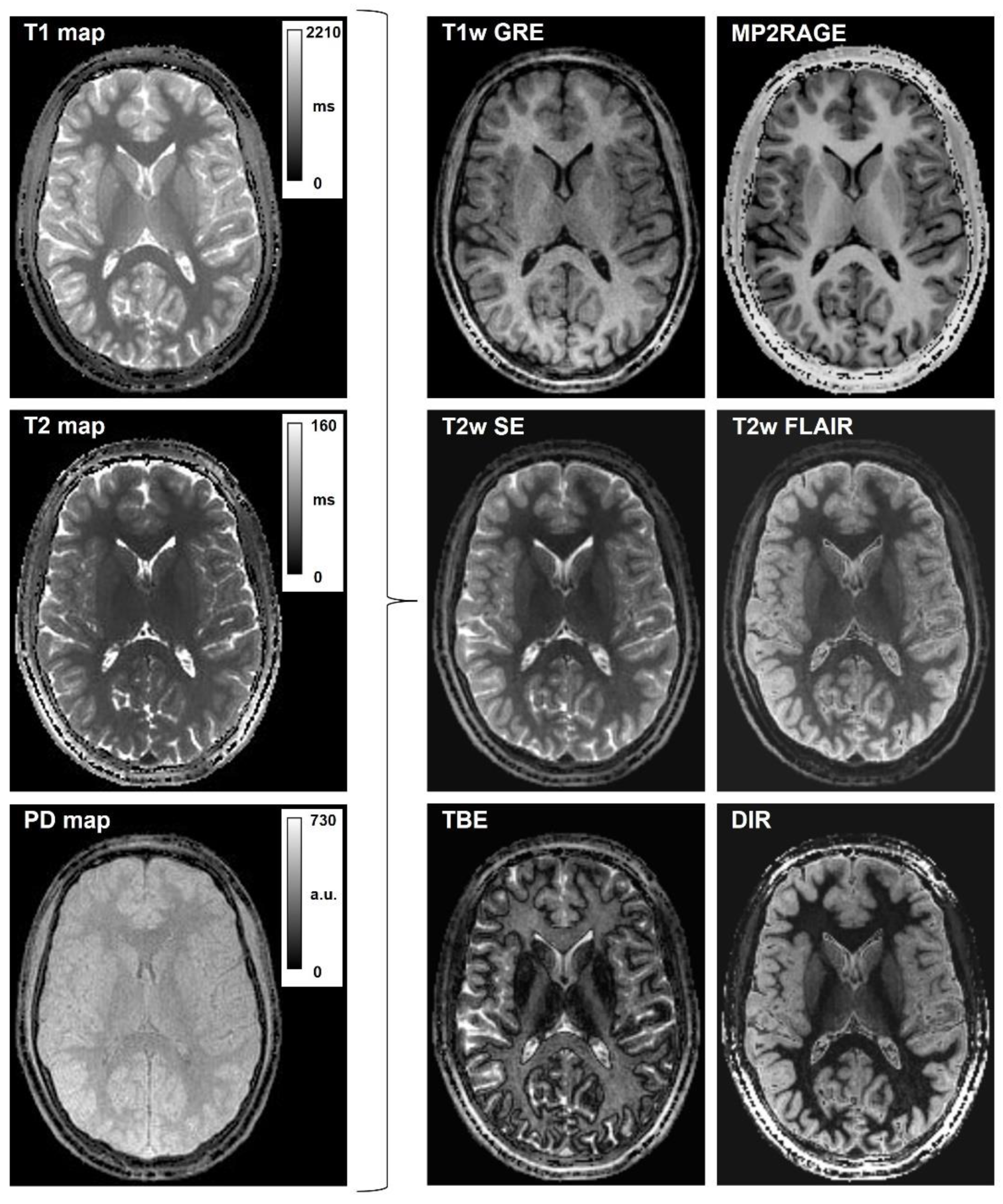 Tomography 09 00137 g004
