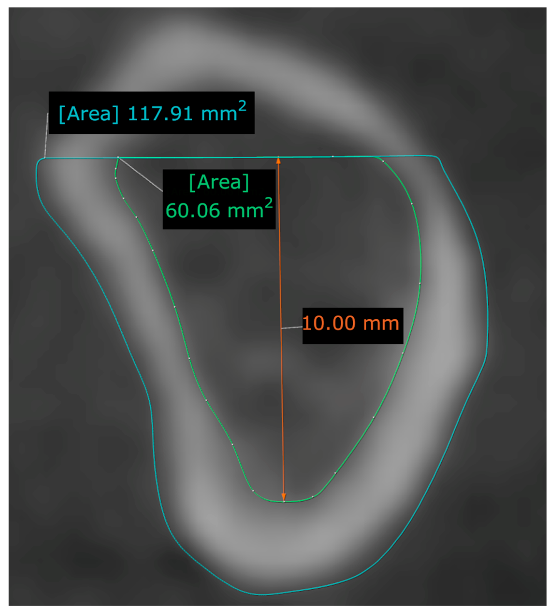 Tomography 09 00141 g002