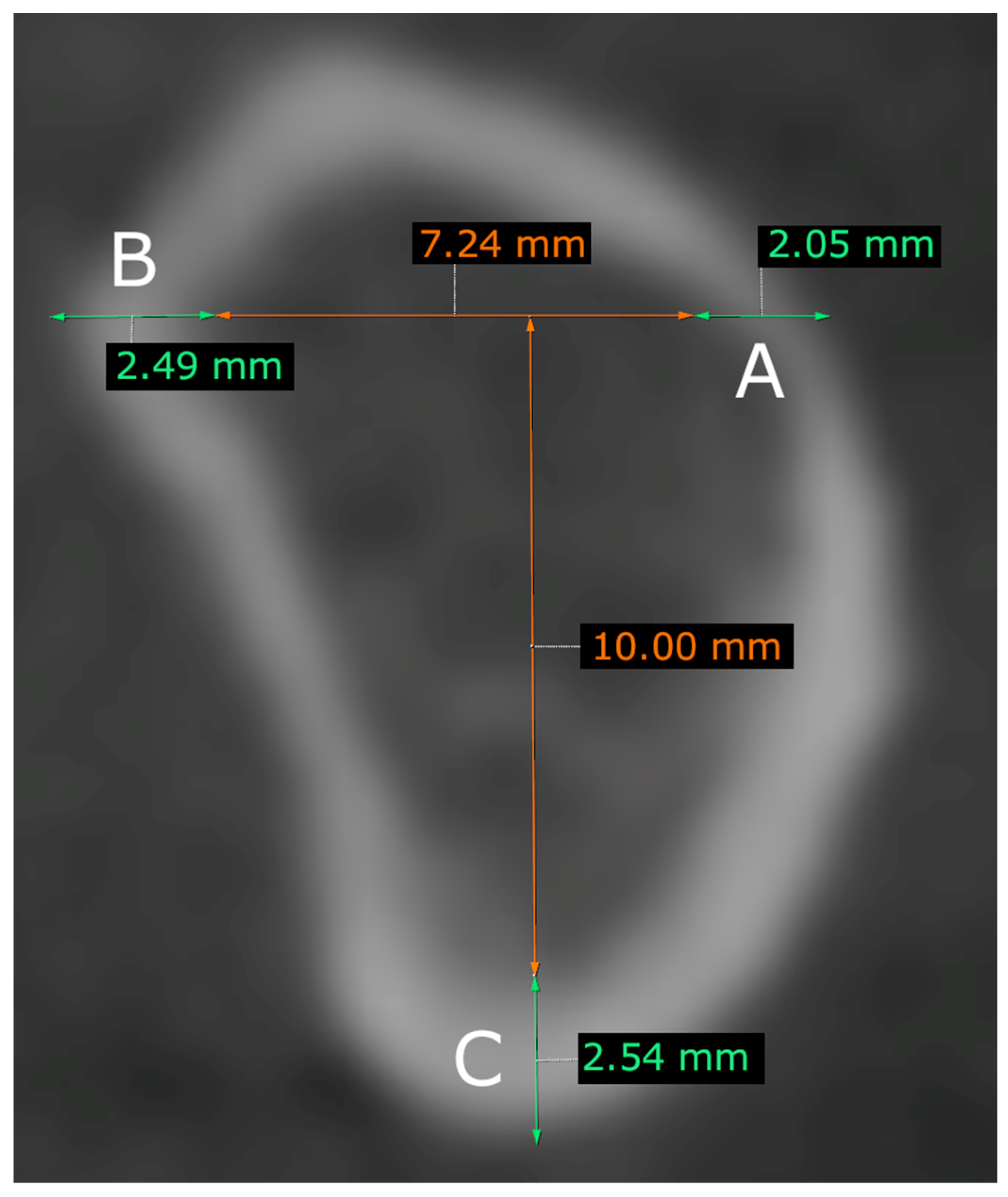 Tomography 09 00141 g003