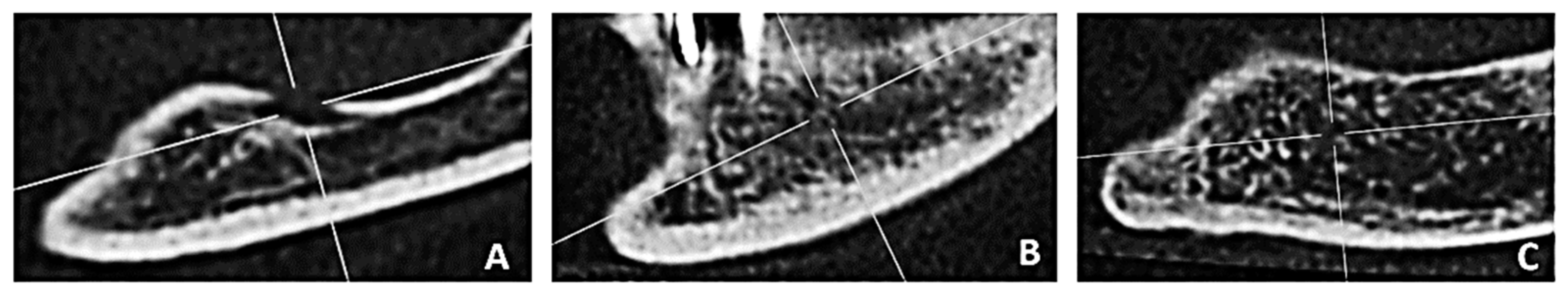 Tomography 09 00141 g004