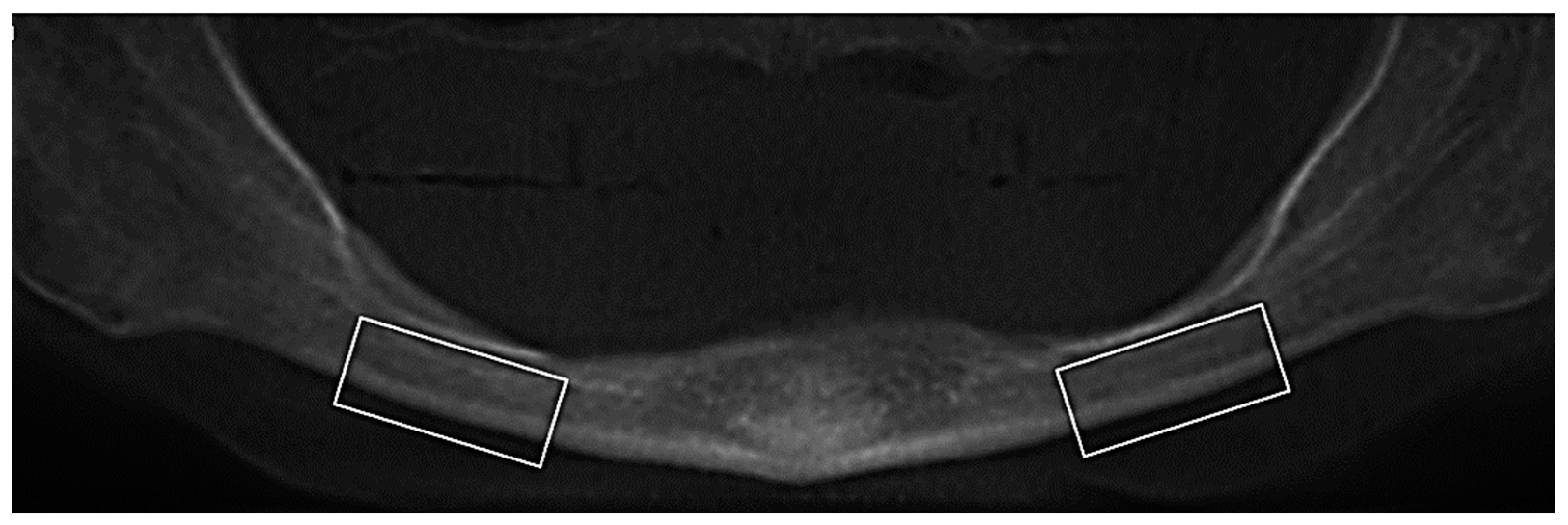 Tomography 09 00141 g005