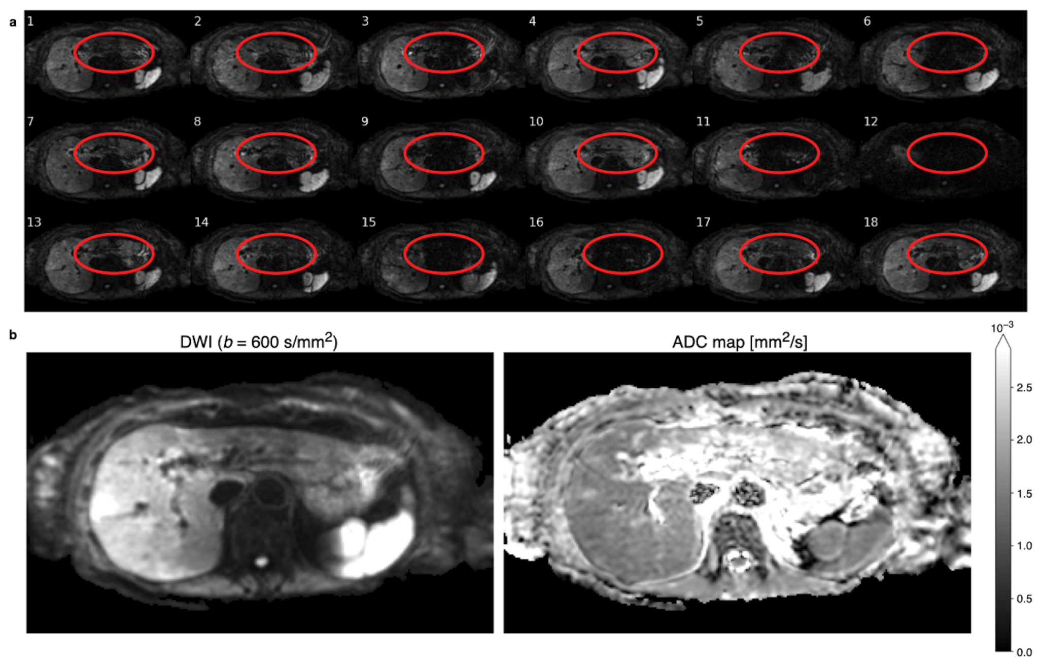 Tomography 09 00146 g001