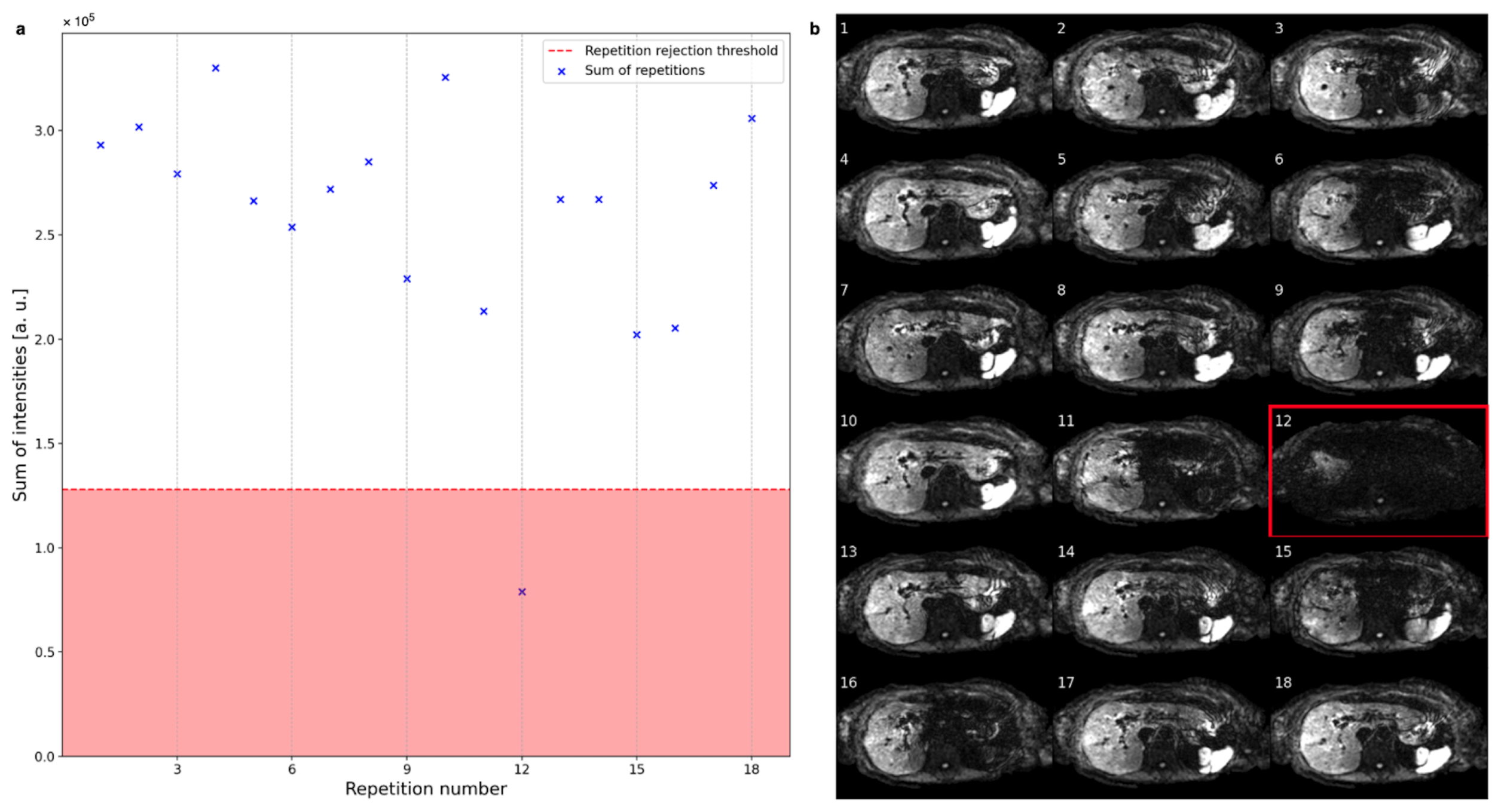 Tomography 09 00146 g003