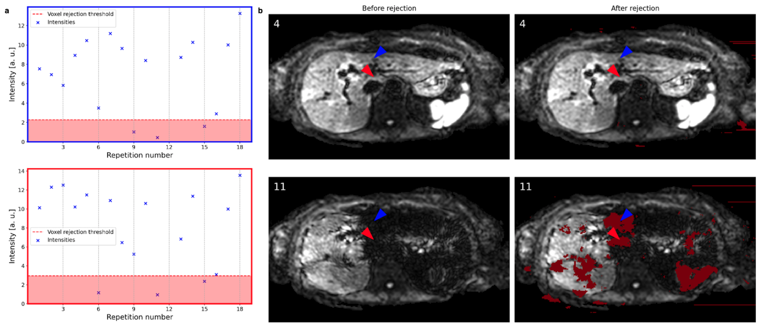 Tomography 09 00146 g004