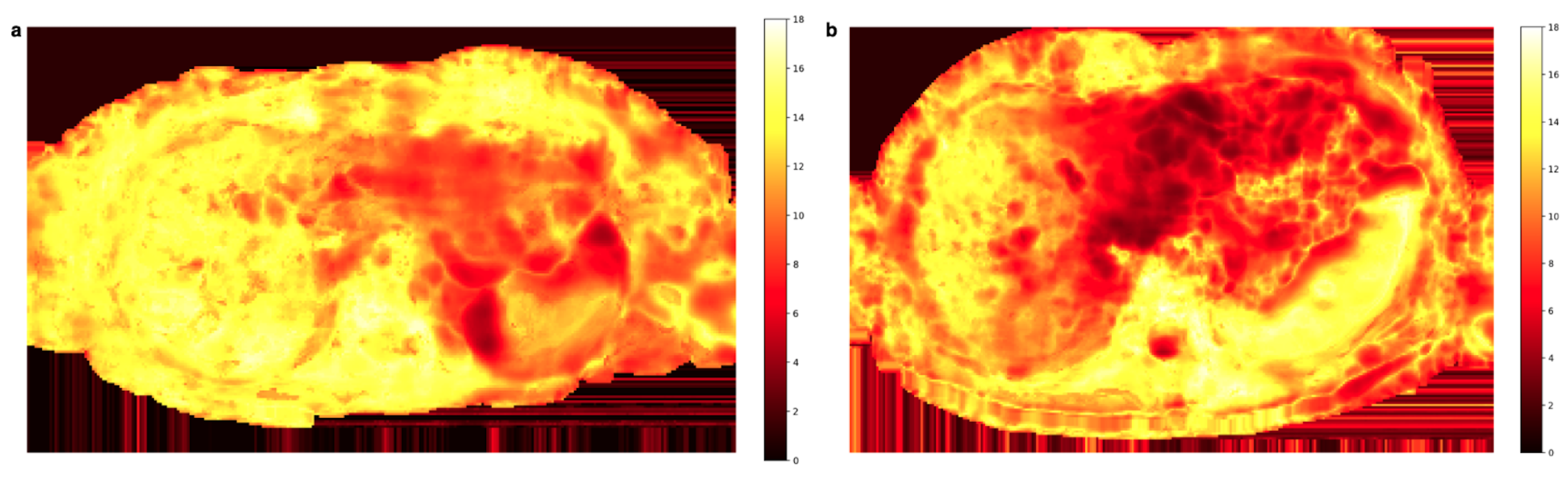 Tomography 09 00146 g005