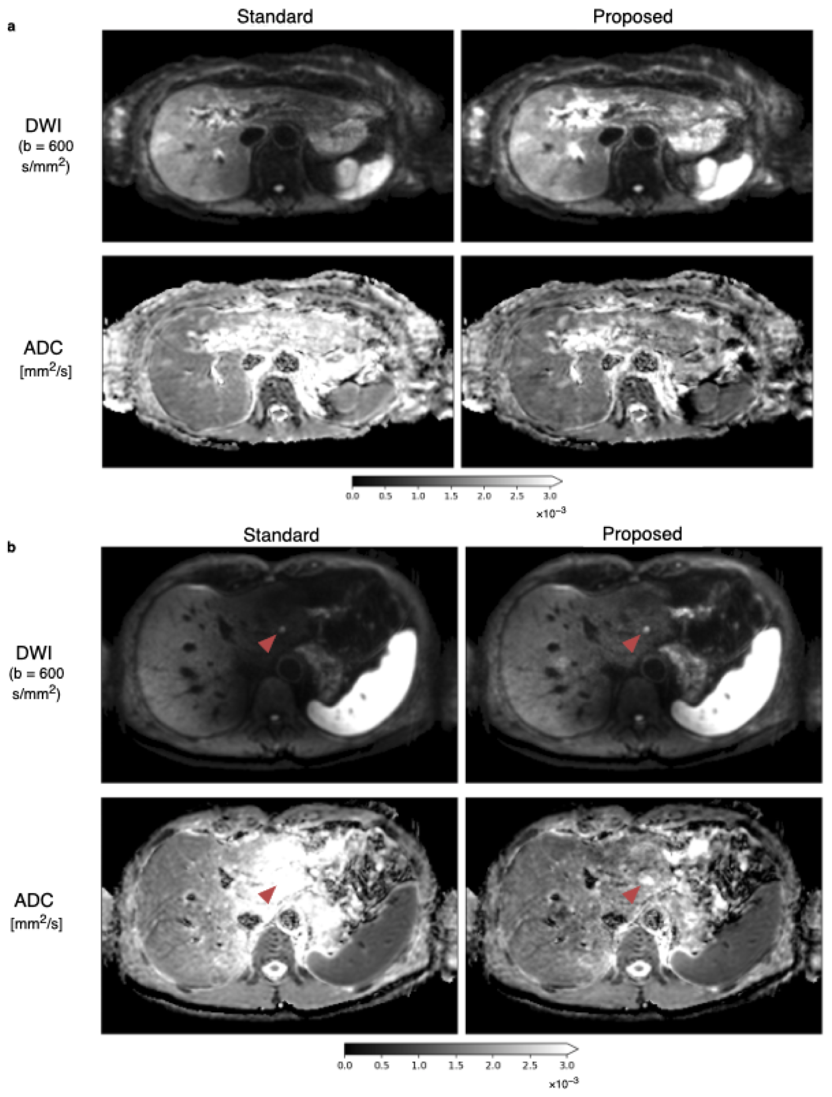 Tomography 09 00146 g006