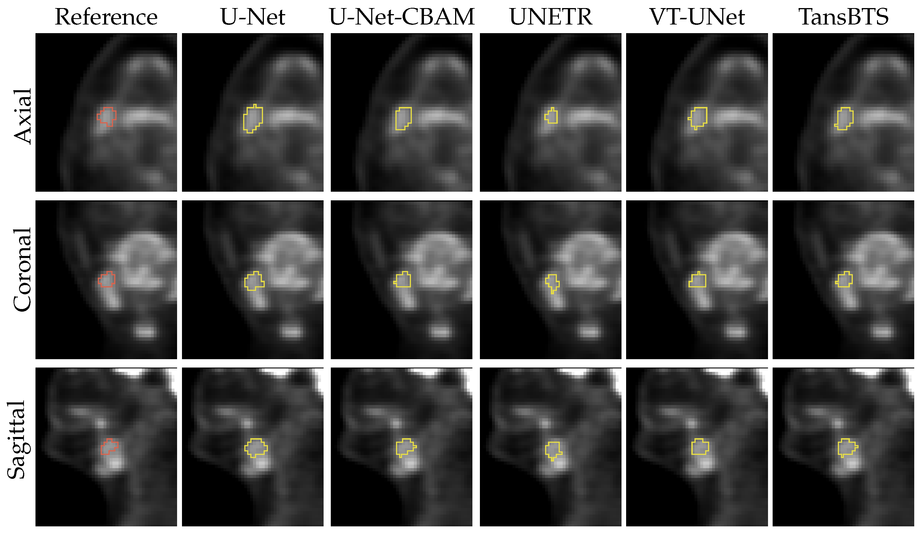 Tomography 09 00151 g014