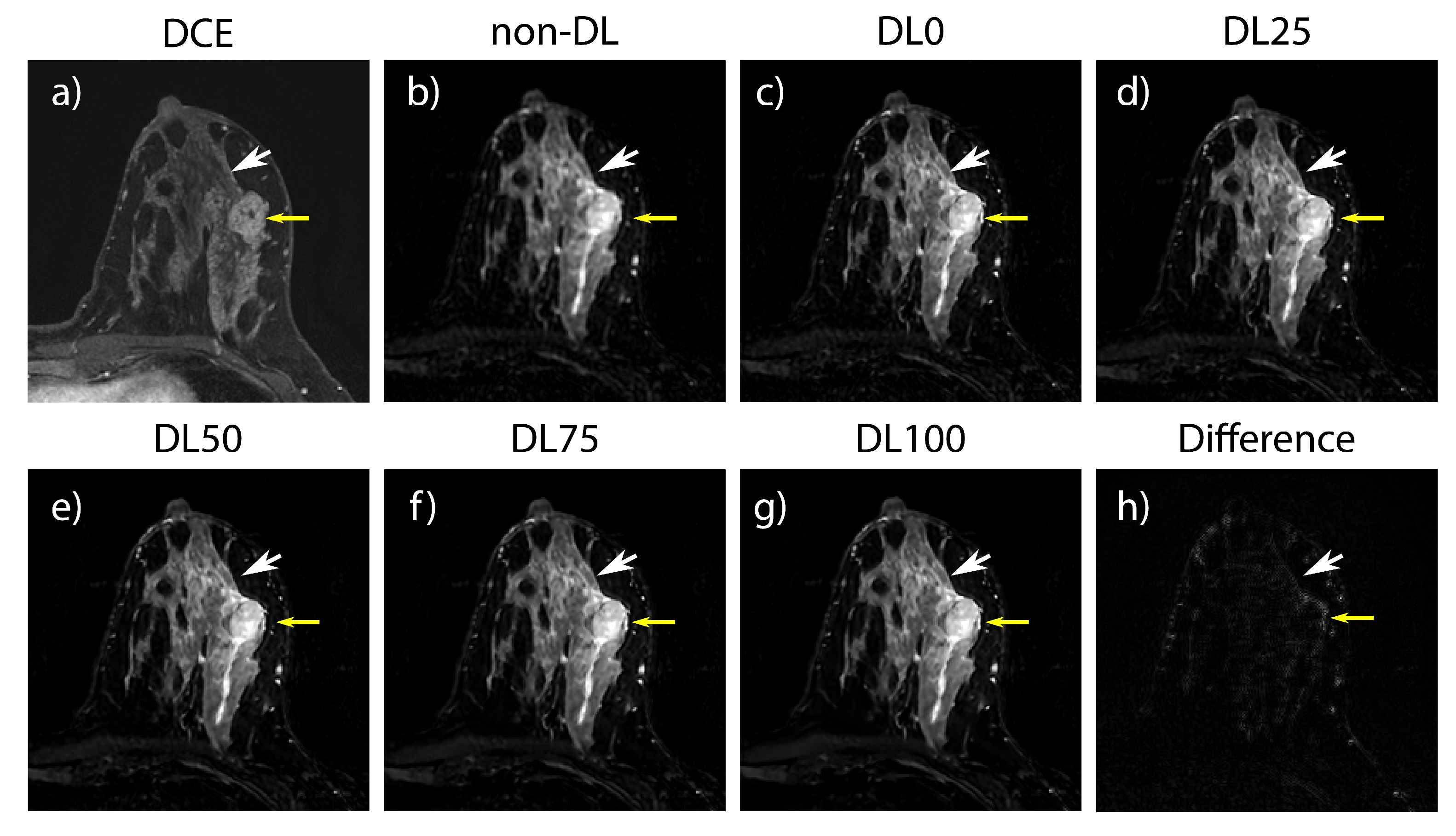 Tomography 09 00152 g002
