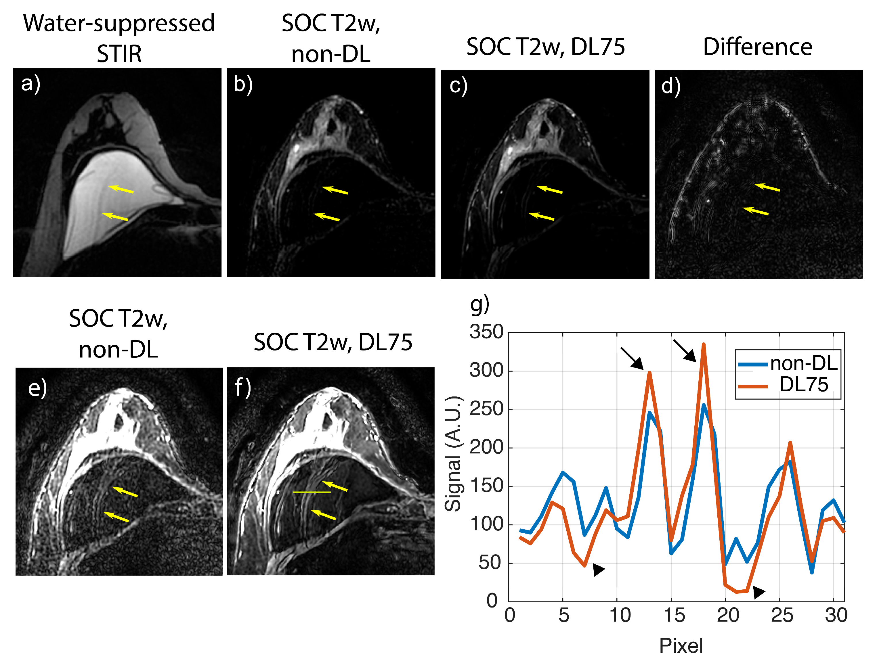 Tomography 09 00152 g003