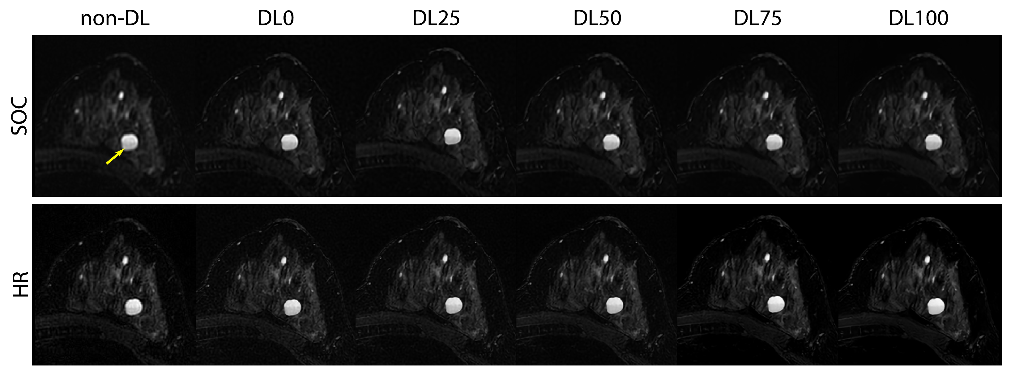 Tomography 09 00152 g005