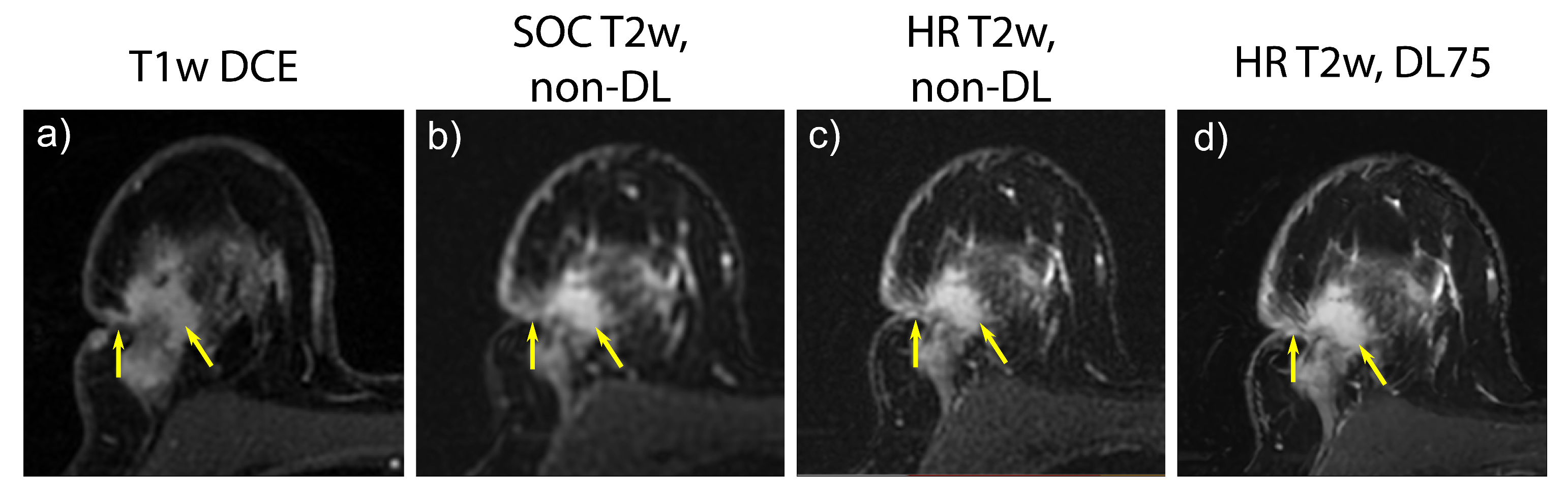 Tomography 09 00152 g006