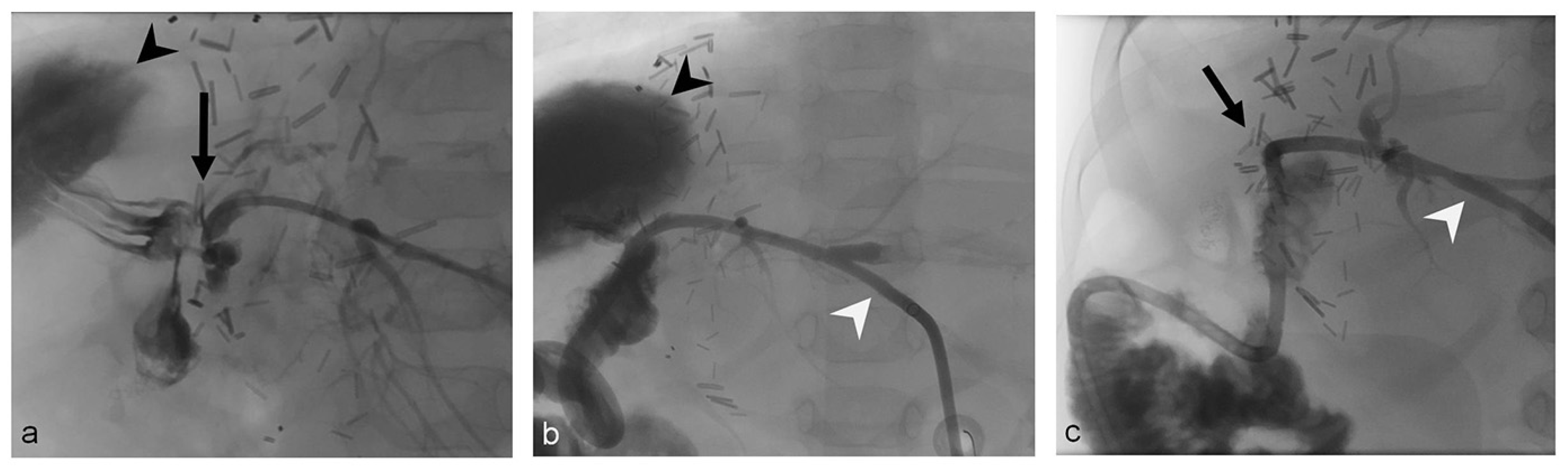 Tomography 09 00153 g001
